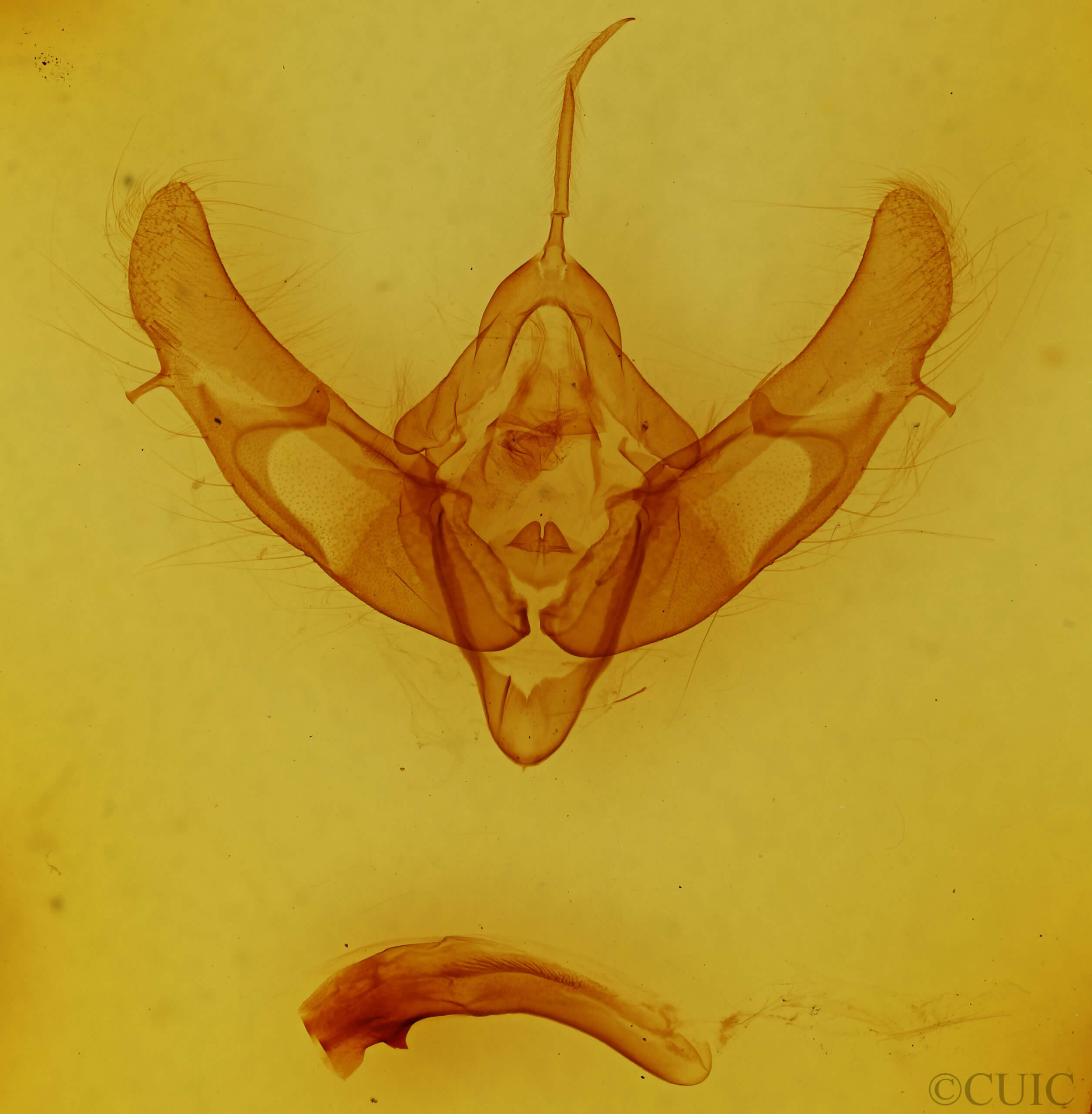 genitalia view of adult Xestia stupenda