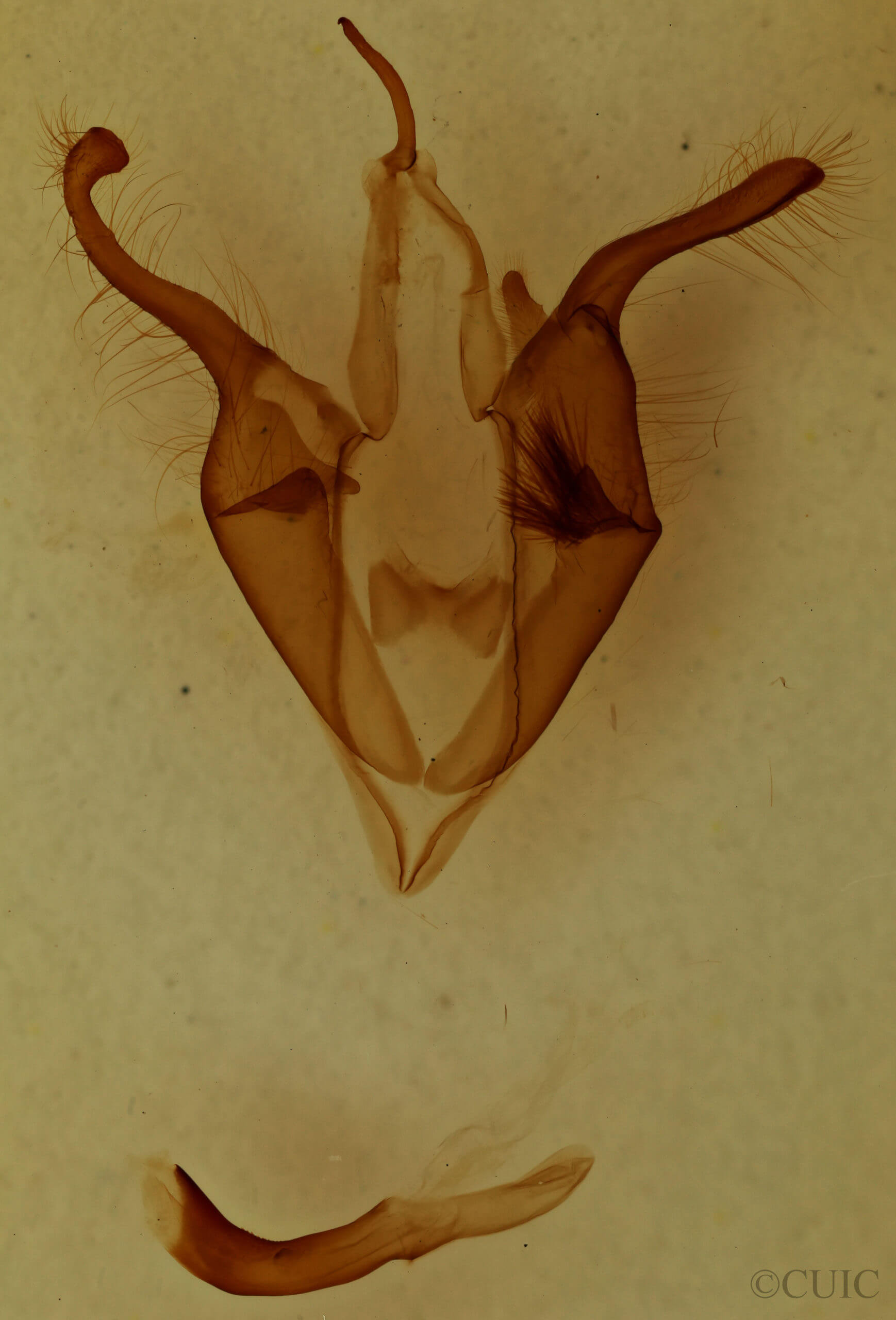 genitalia view of adult Zale metatoides