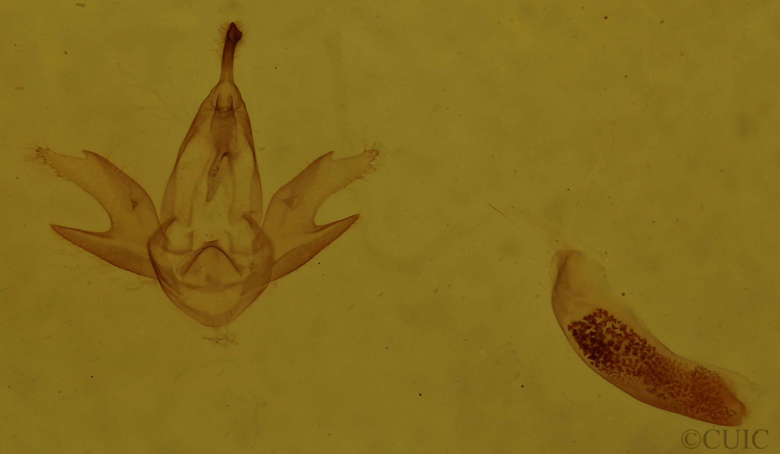 genitalia view of adult Zanclognatha cruralis