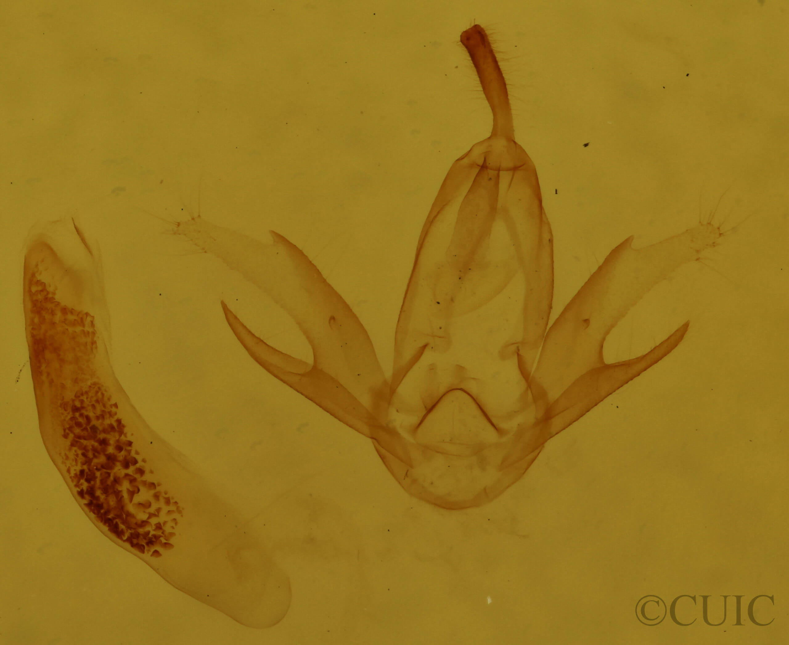 genitalia view of adult Zanclognatha cruralis