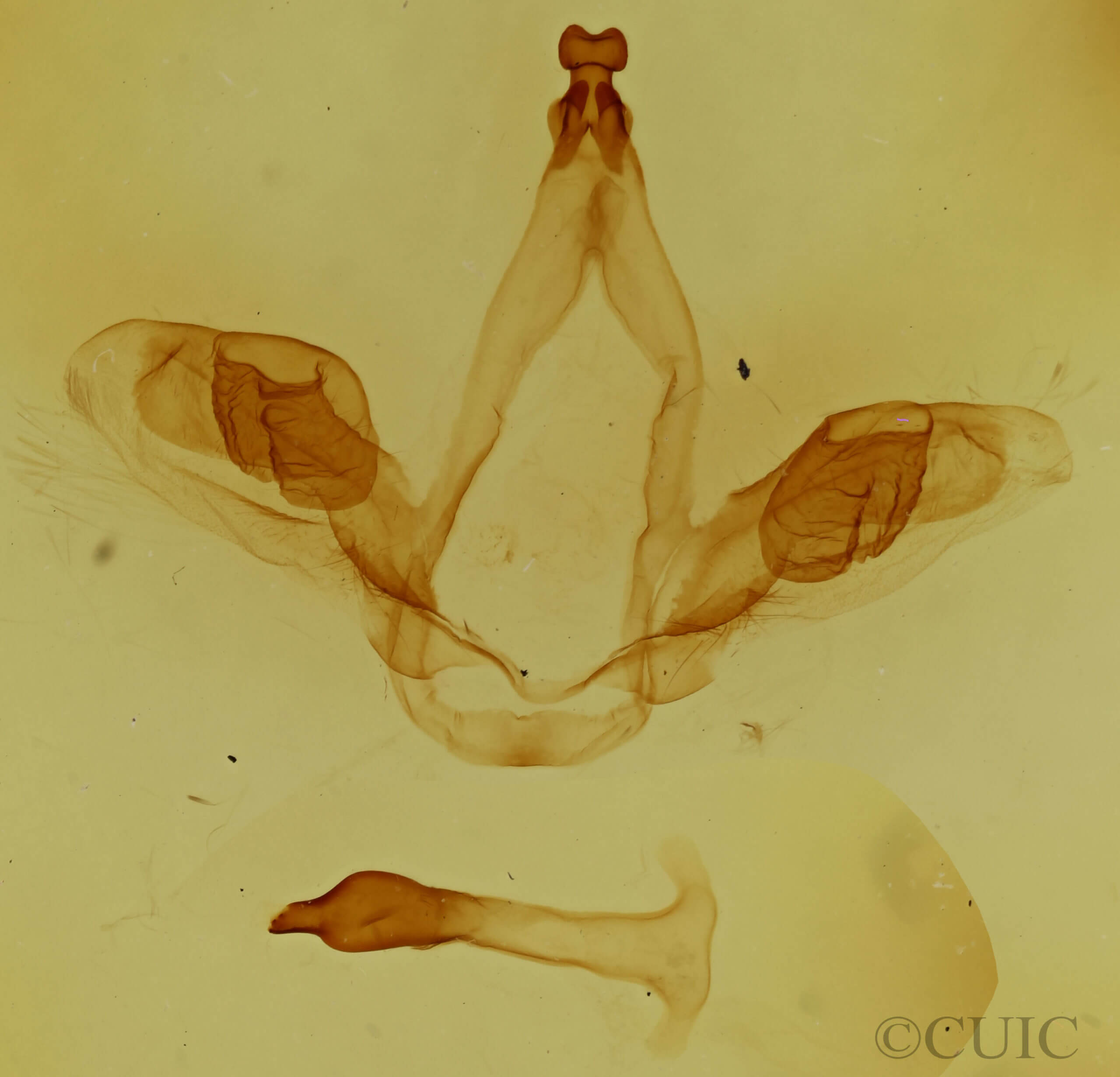genitalia view of adult Oedemasia semirufescens