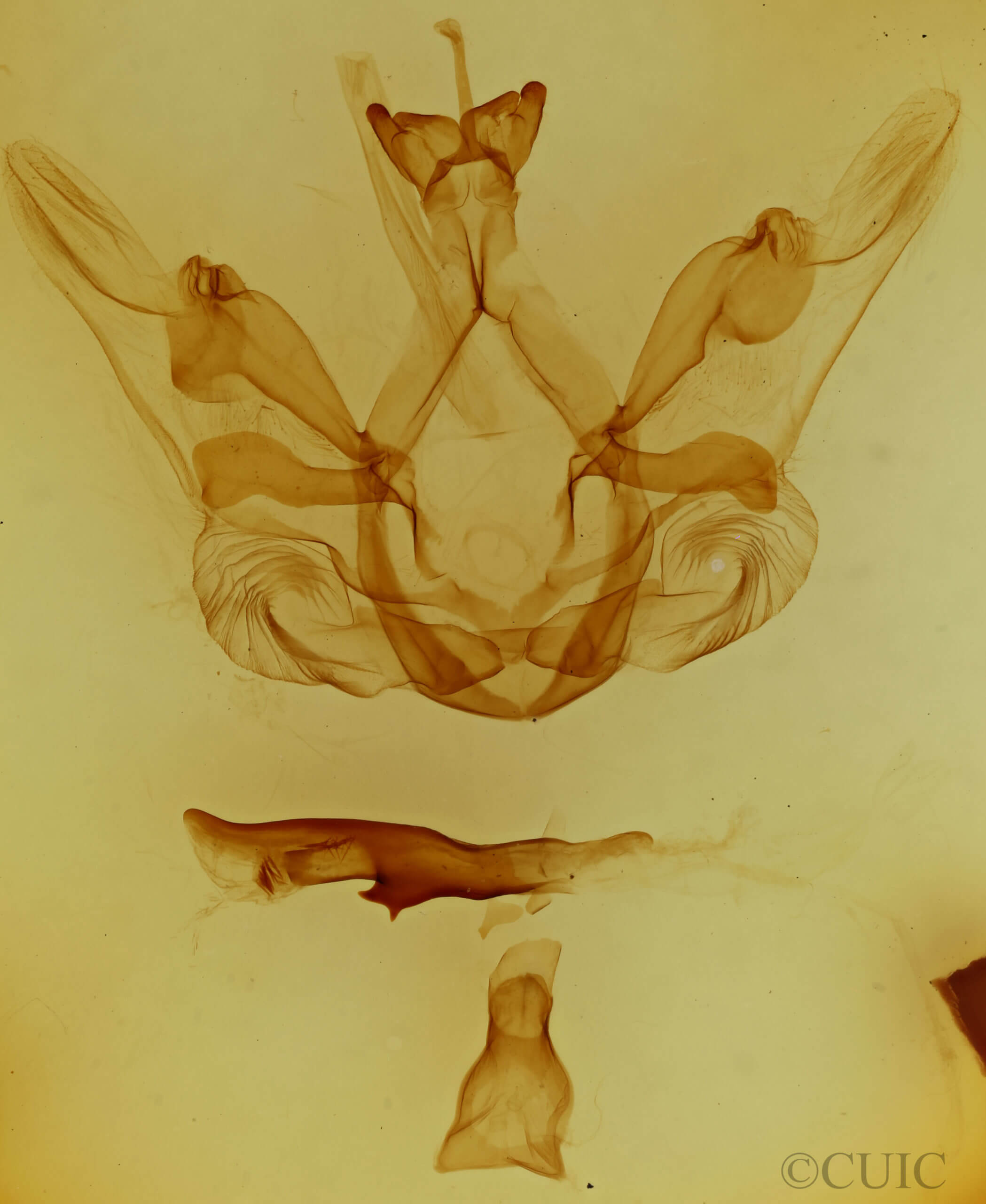 genitalia view of adult Nystalea eutalanta