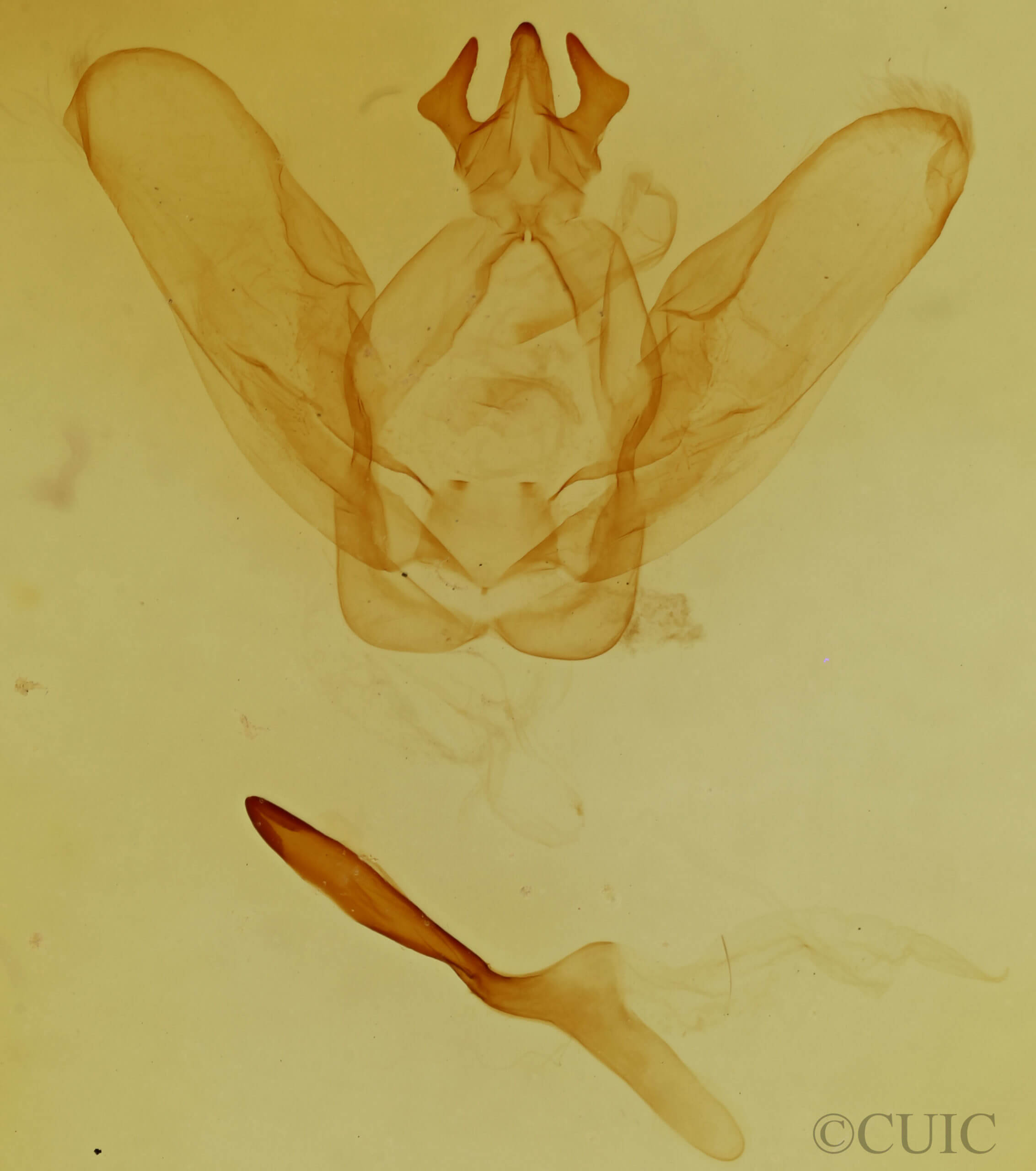 genitalia view of adult Ianassa perangulata