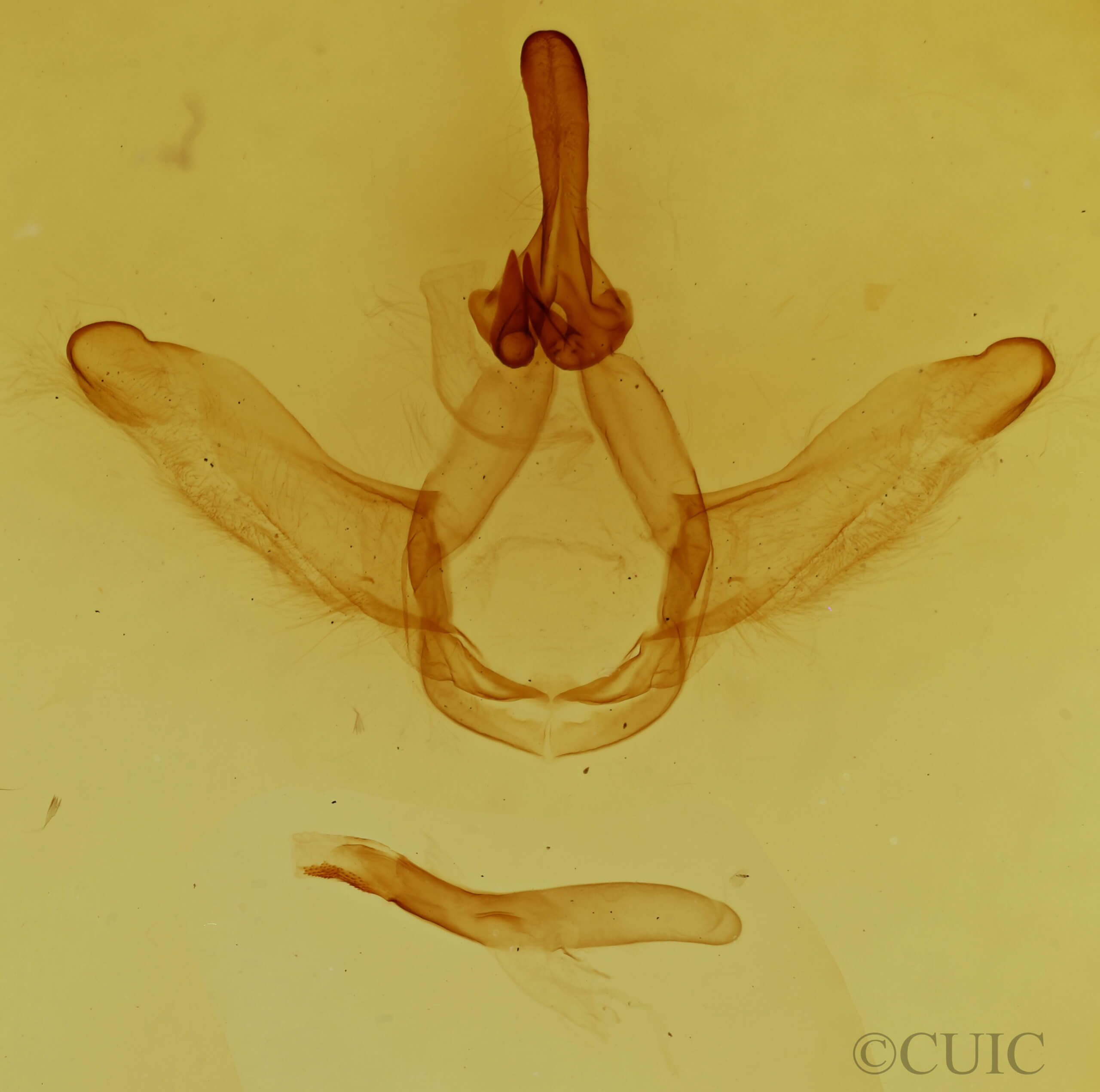 genitalia view of adult Ianassa pallida