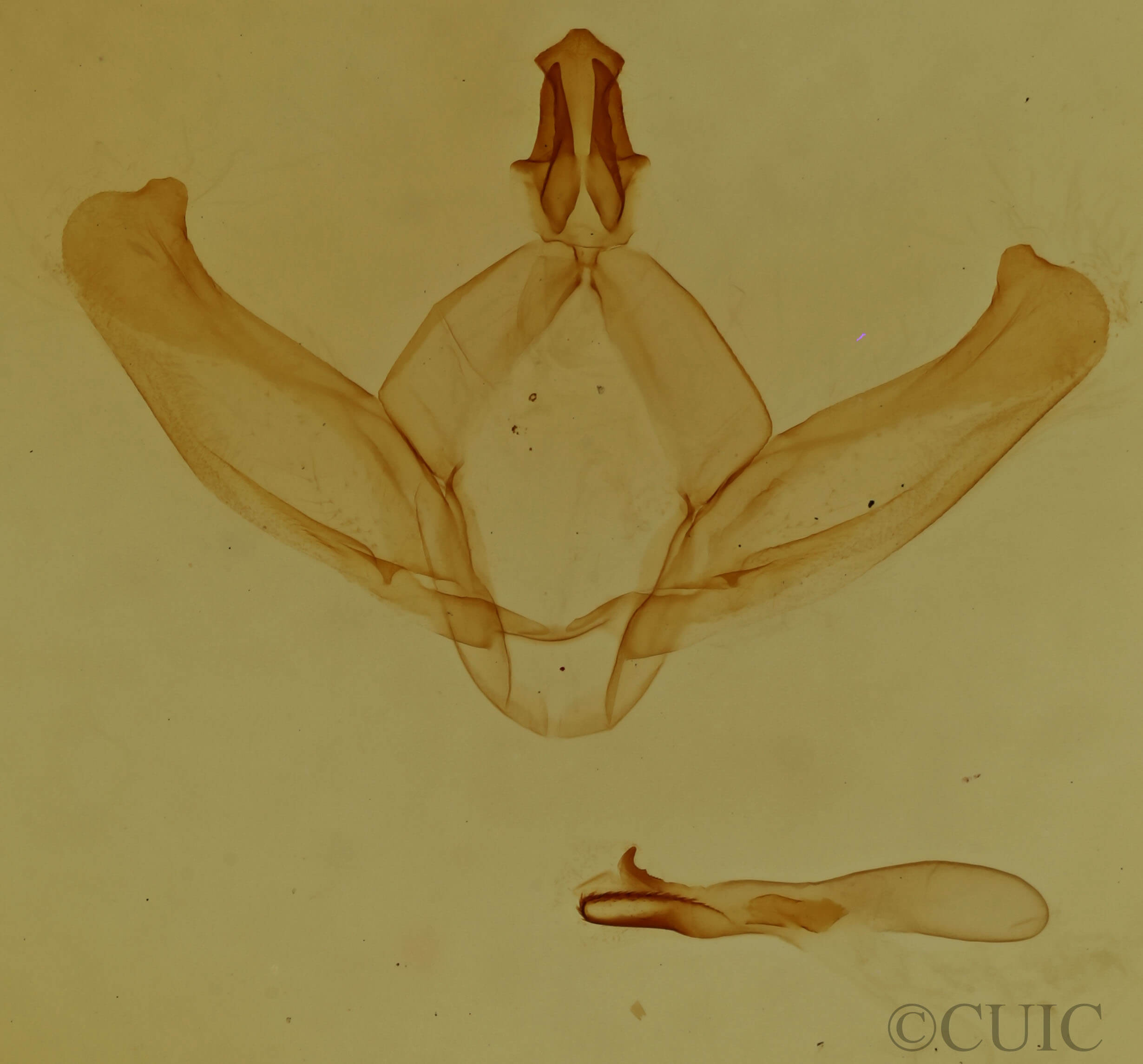 genitalia view of adult Hyparpax perophoroides