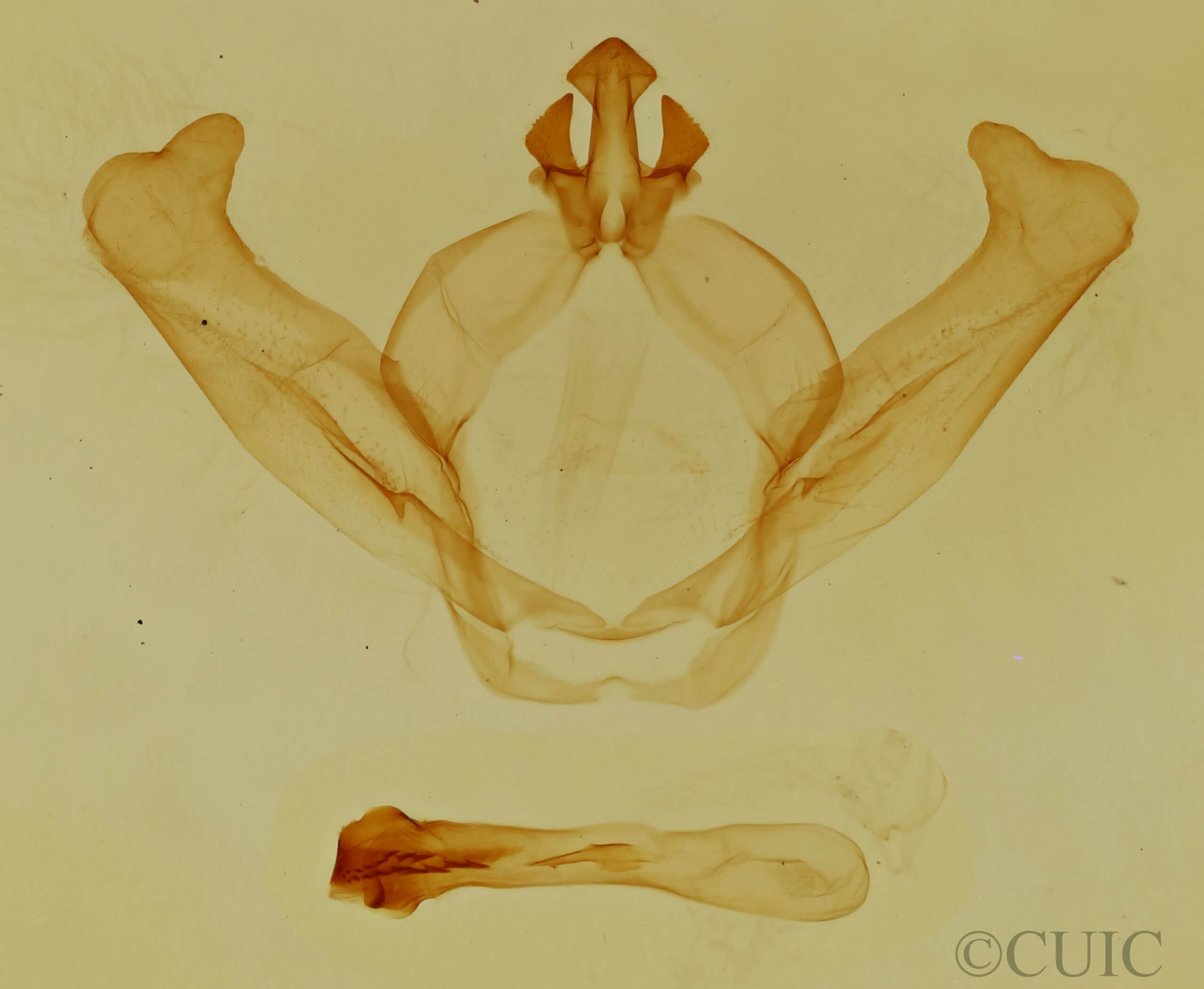 genitalia view of adult Hyparpax aurostriata
