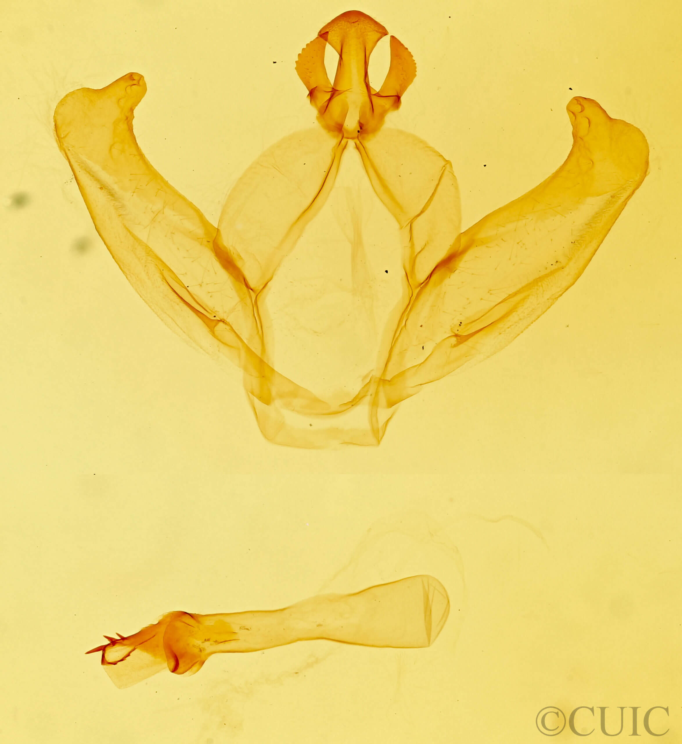 genitalia view of adult Hyparpax  venus