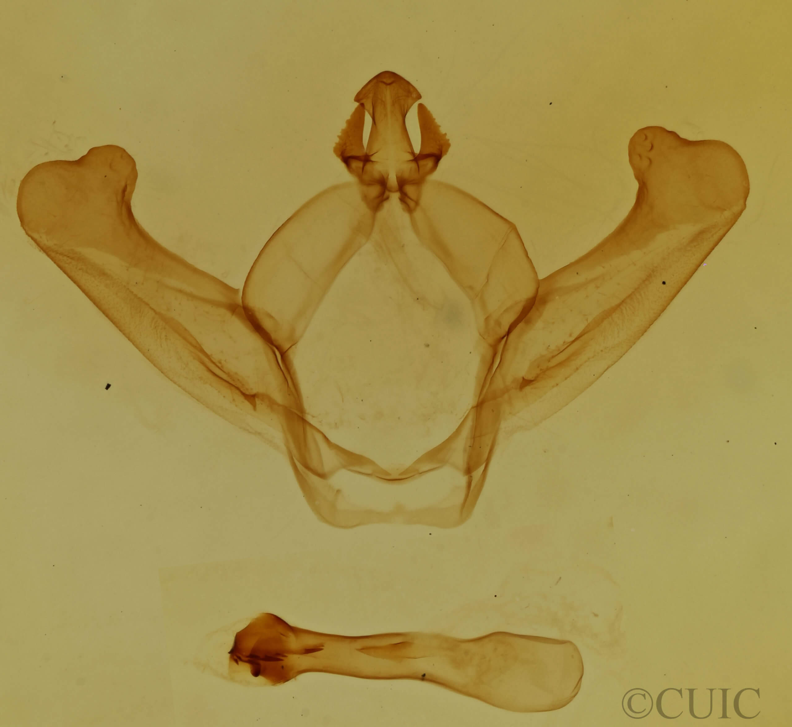 genitalia view of adult Hyparpax aurora