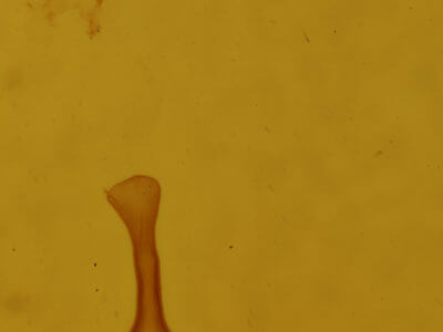 genitalia view of adult Lepidoptera