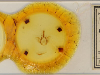 slide view of adult Disphragis mortis