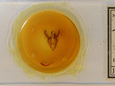 slide view of adult Zale buchholzi