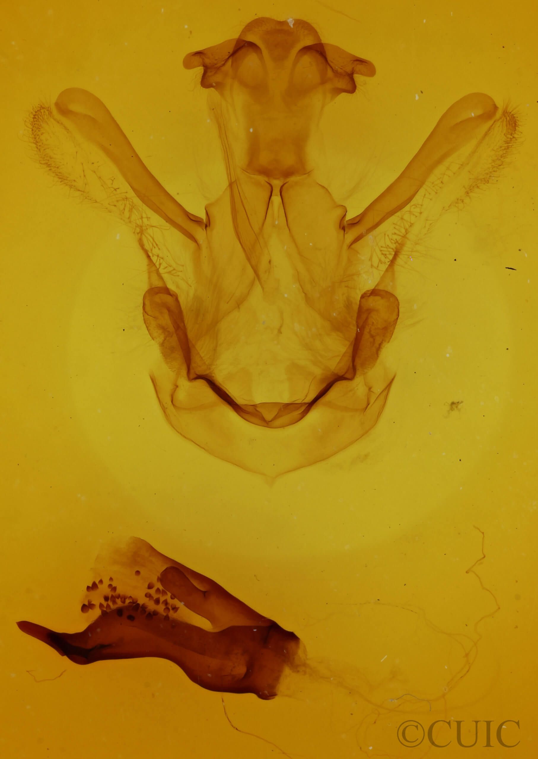 genitalia view of adult Symmerista  albifrons