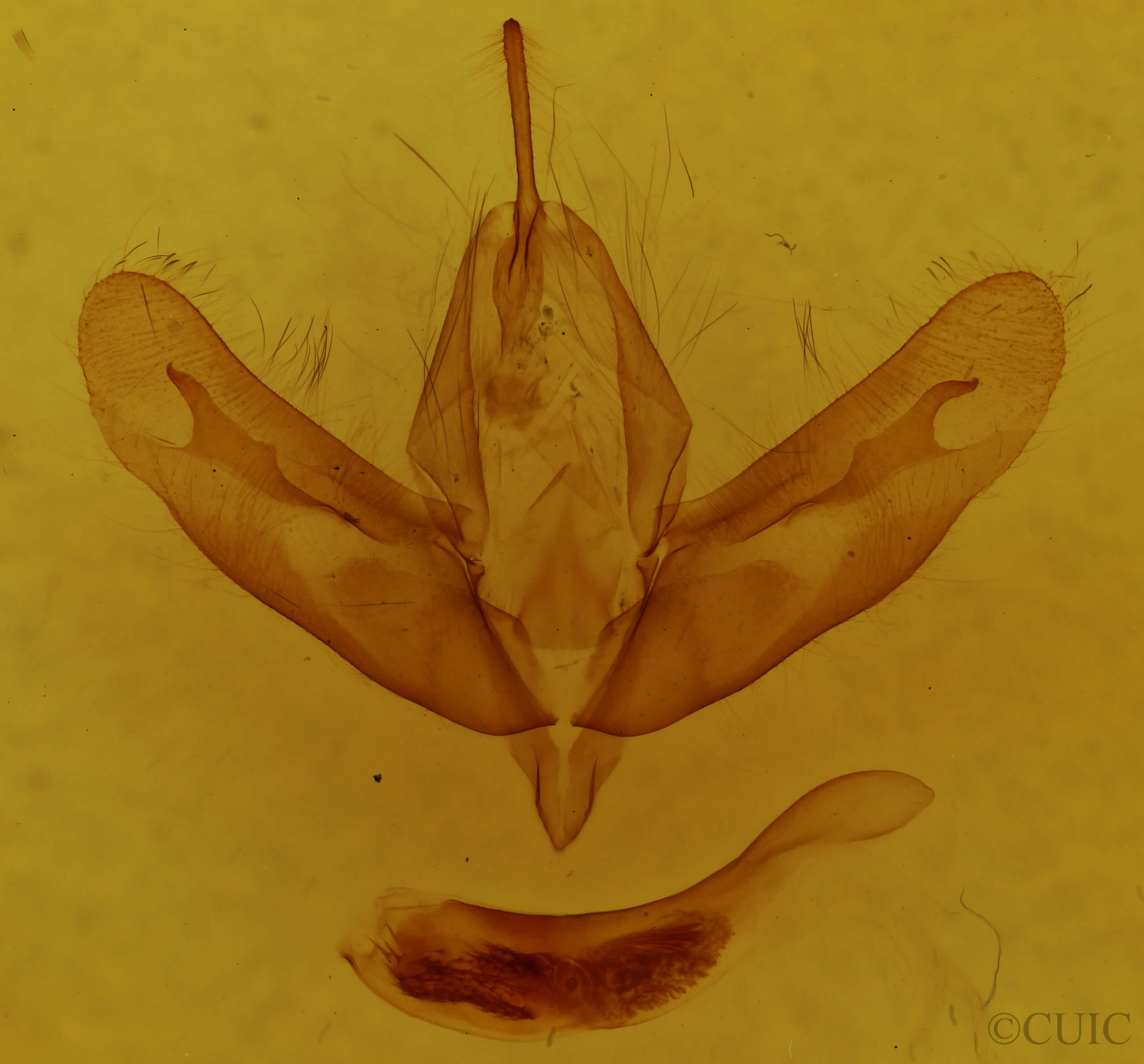 genitalia view of adult Acronicta haesitata