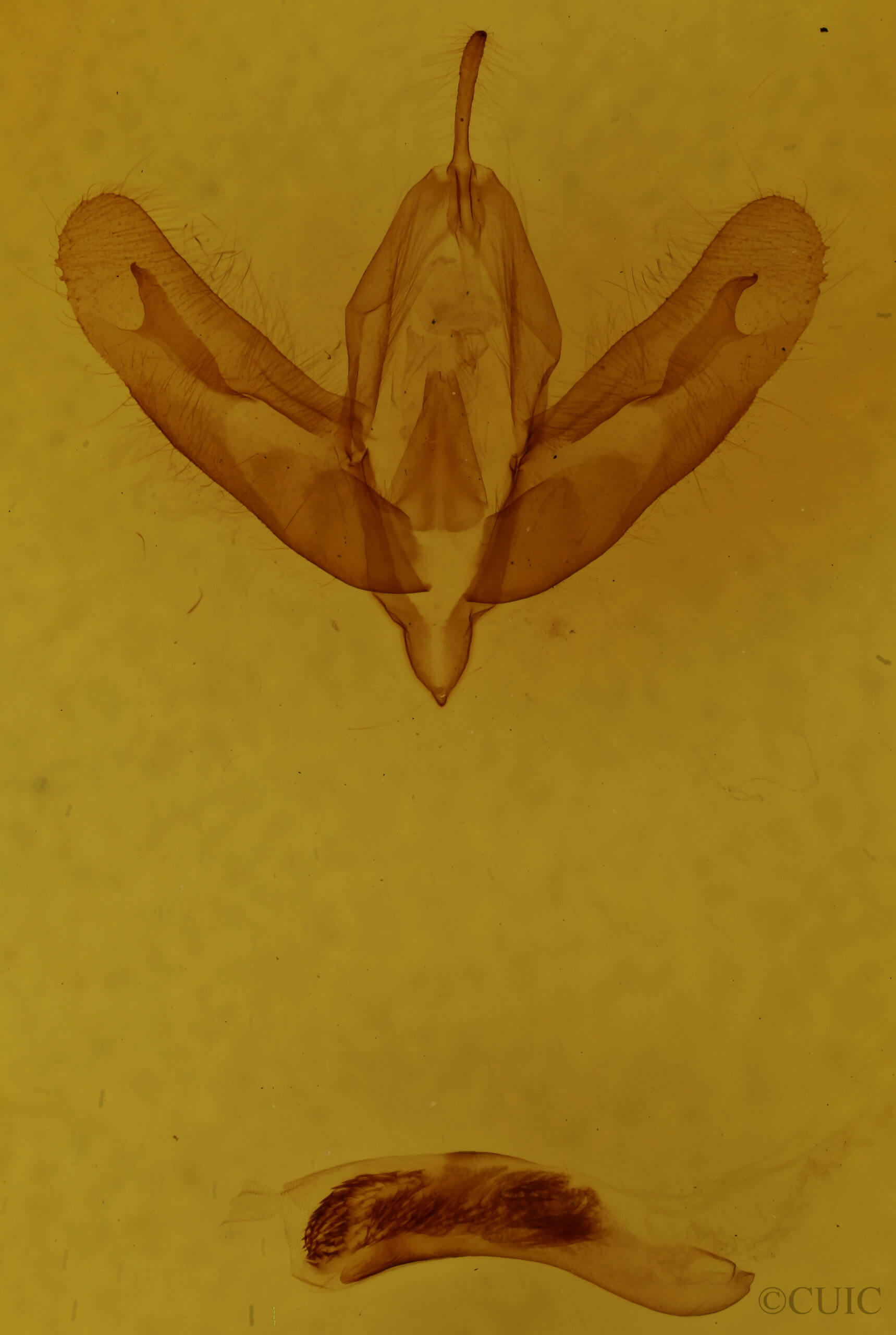 genitalia view of adult Acronicta haesitata