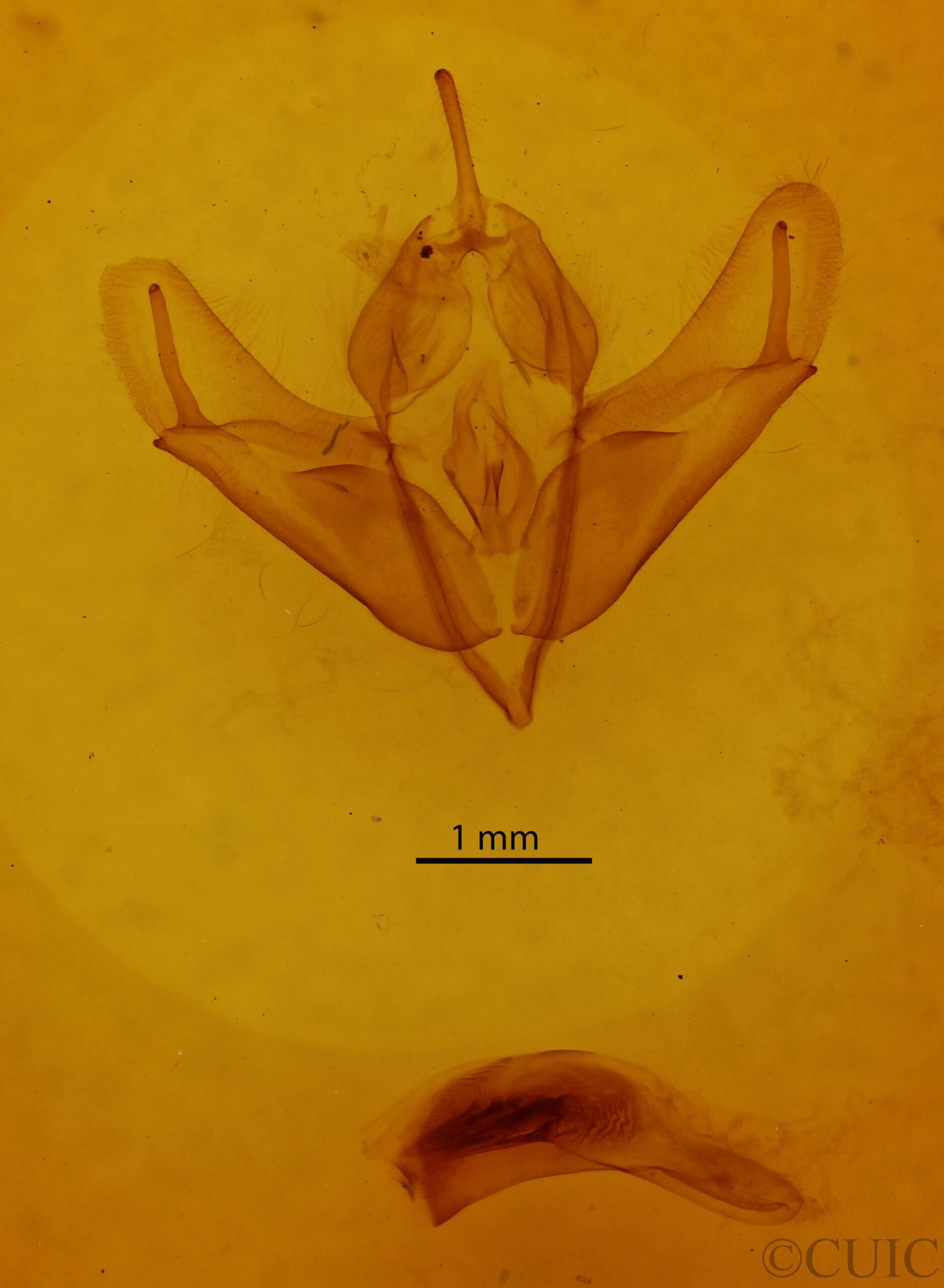 genitalia view of adult Acronicta longa