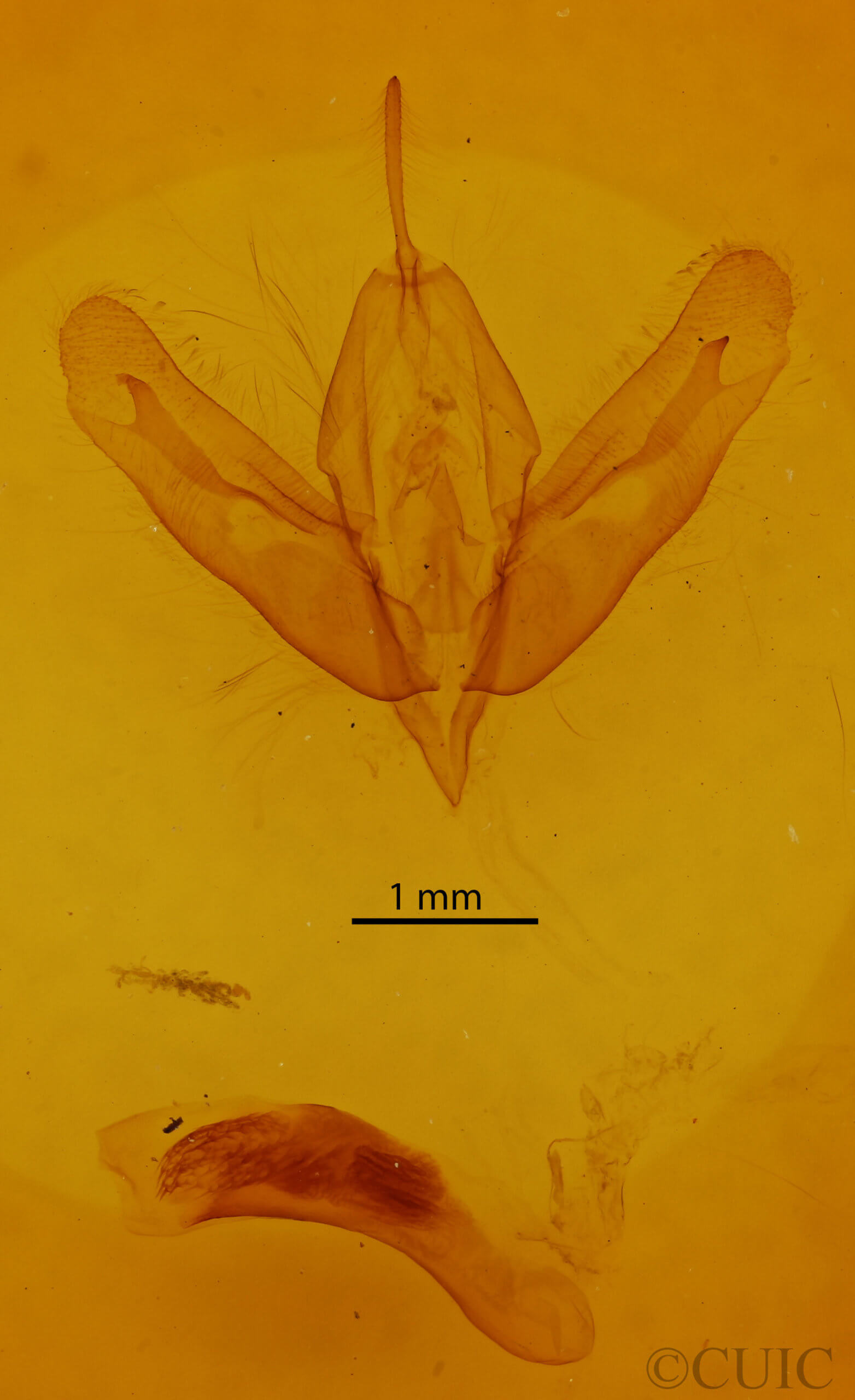 genitalia view of adult Acronicta modica