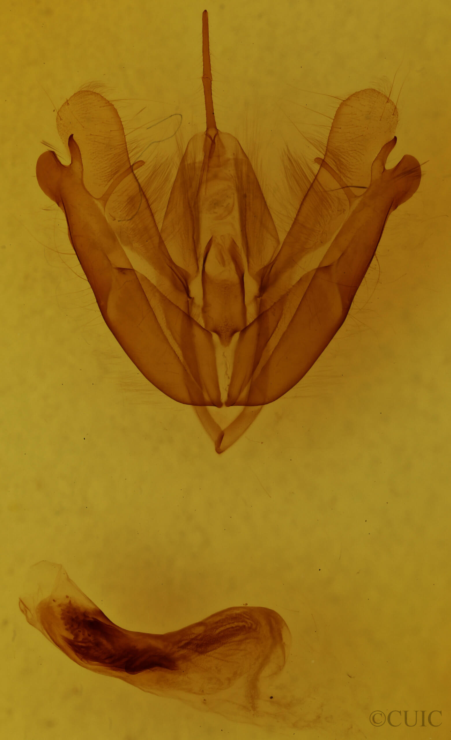 genitalia view of adult Acronicta subochrea