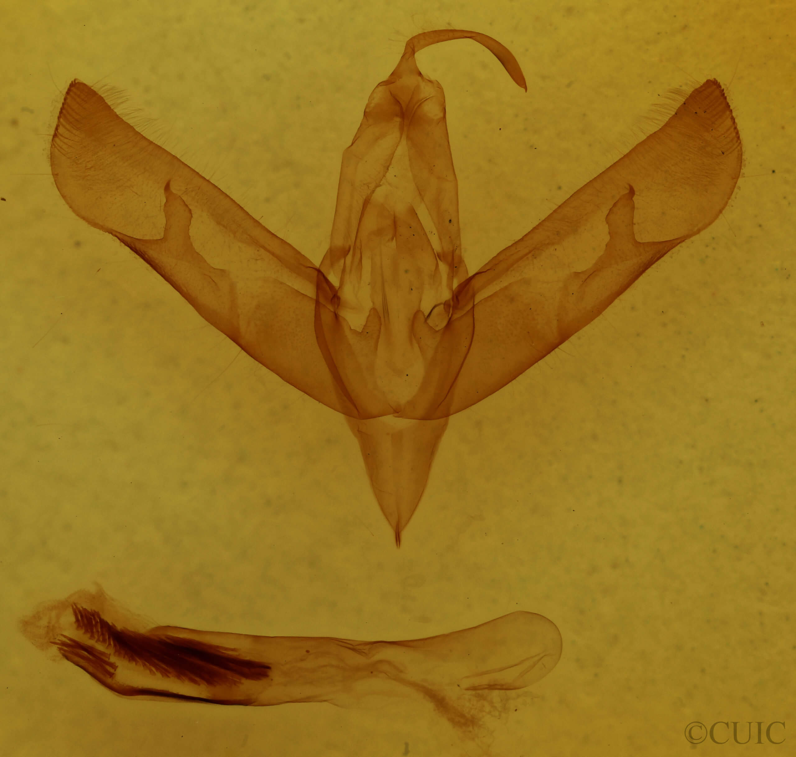 genitalia view of adult Sympistis