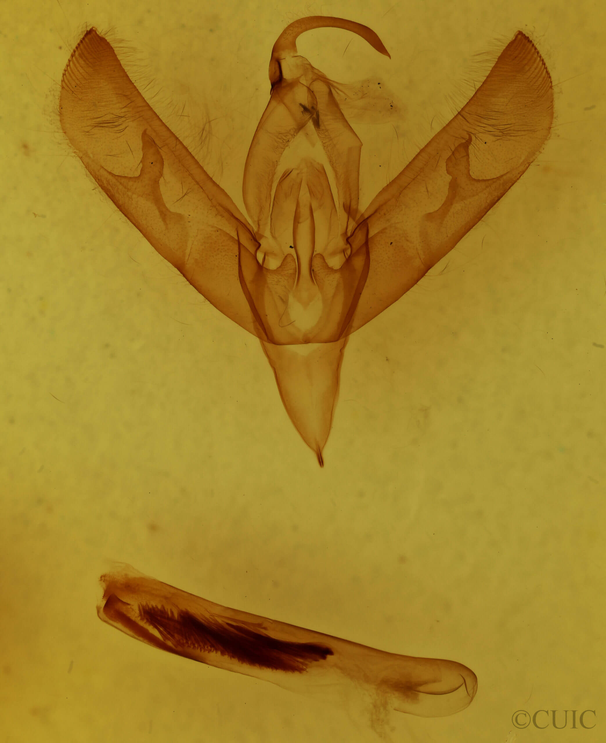 genitalia view of adult Sympistis