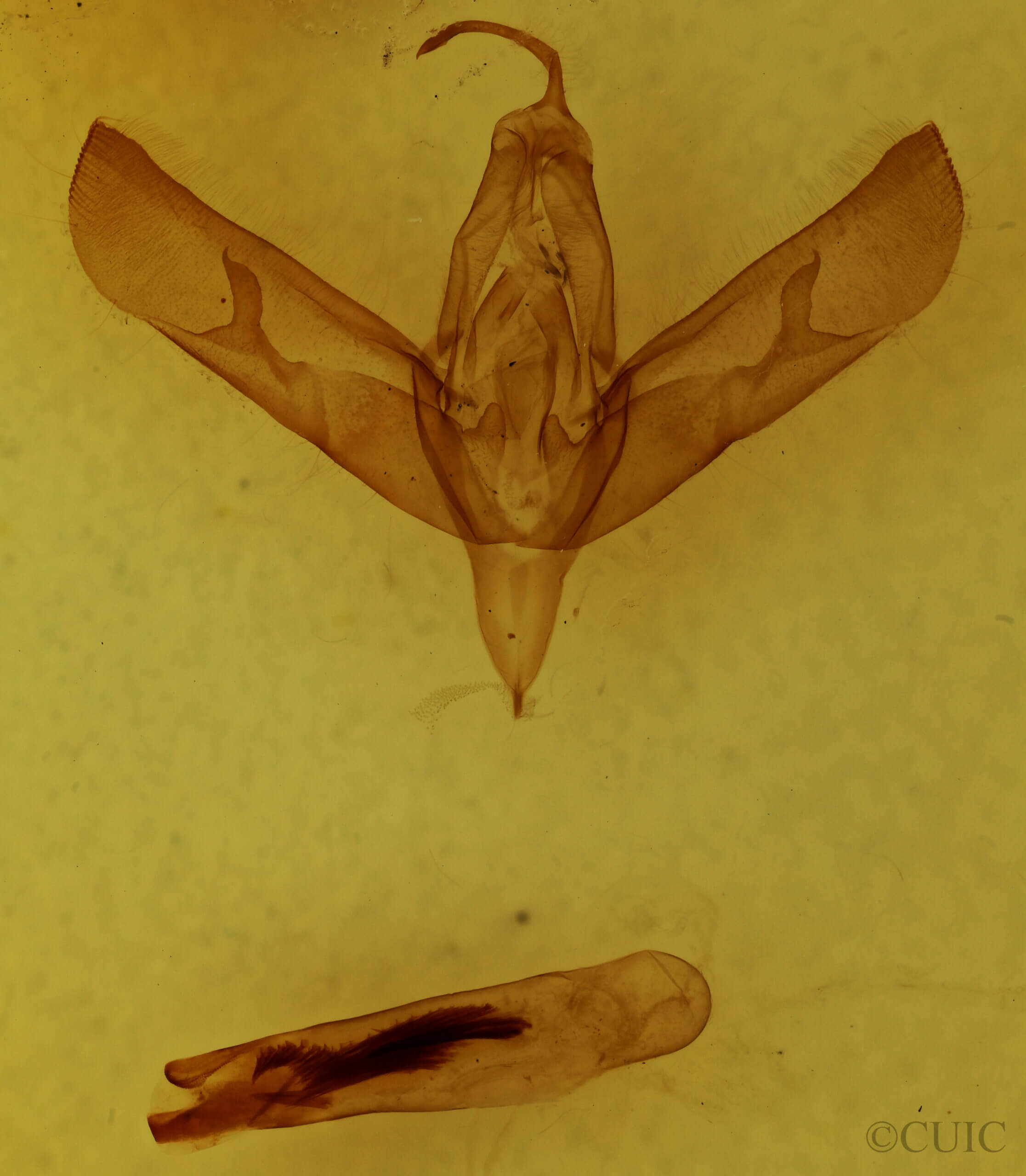 genitalia view of adult Sympistis