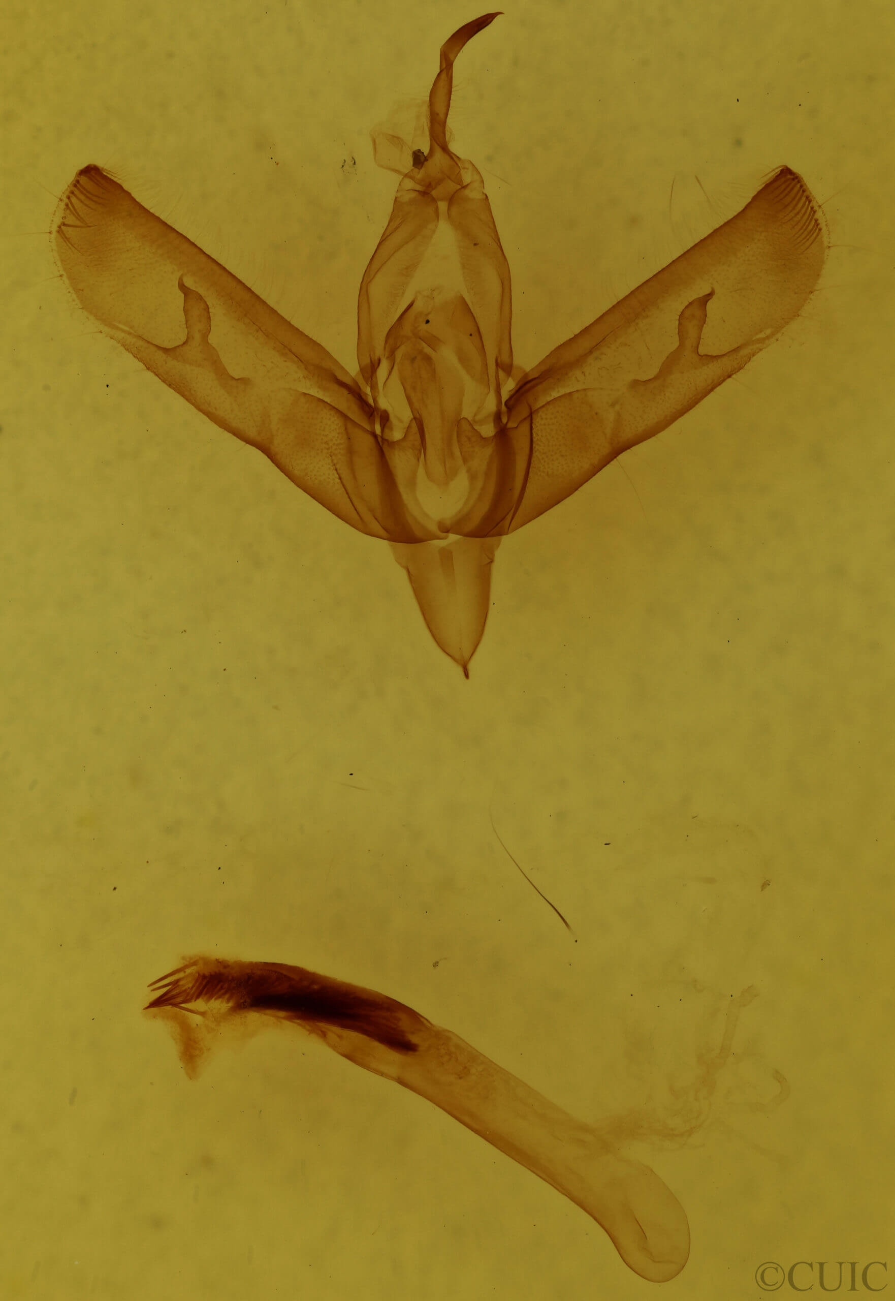 genitalia view of adult Sympistis forbesi