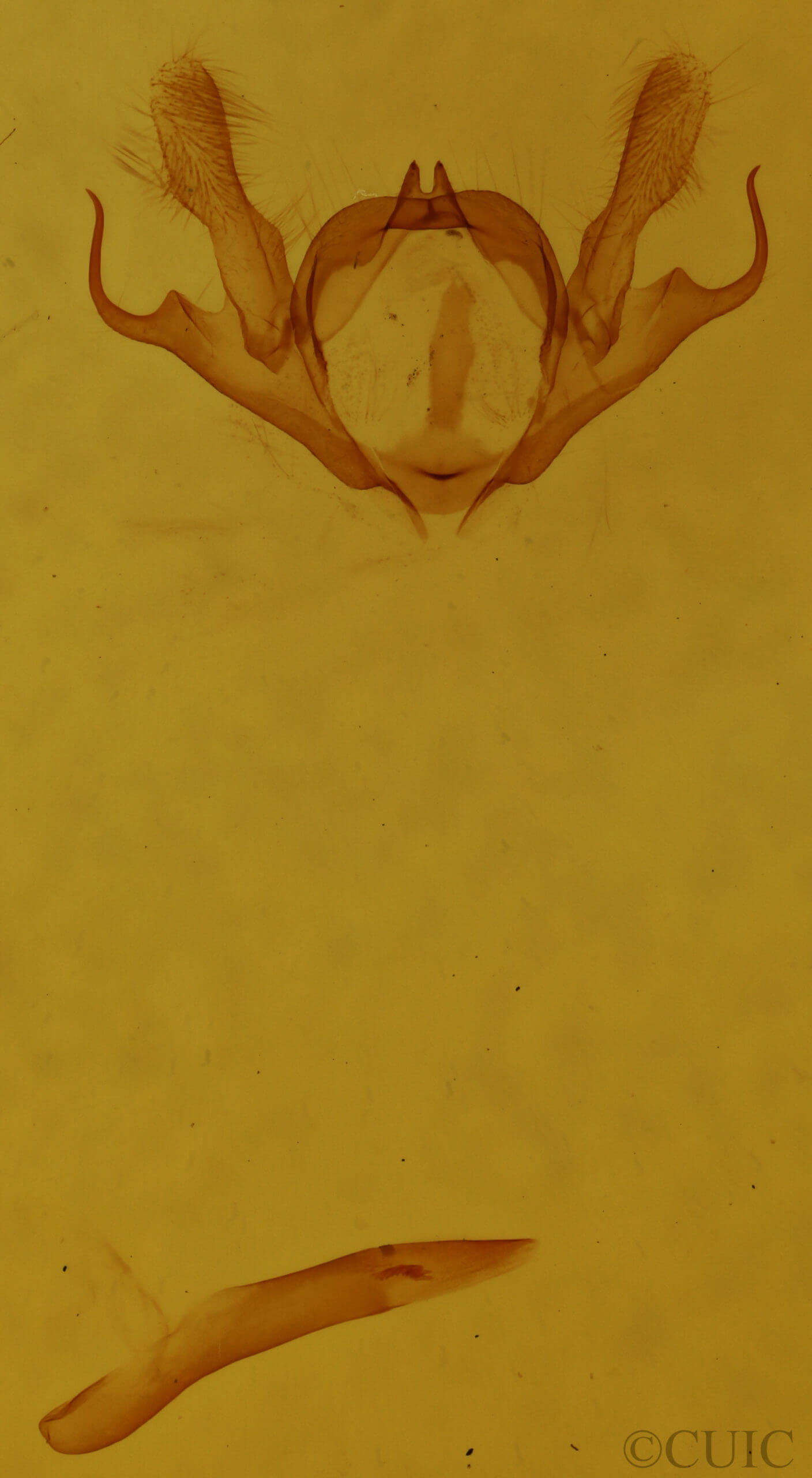 genitalia view of adult Iridopsis humaria
