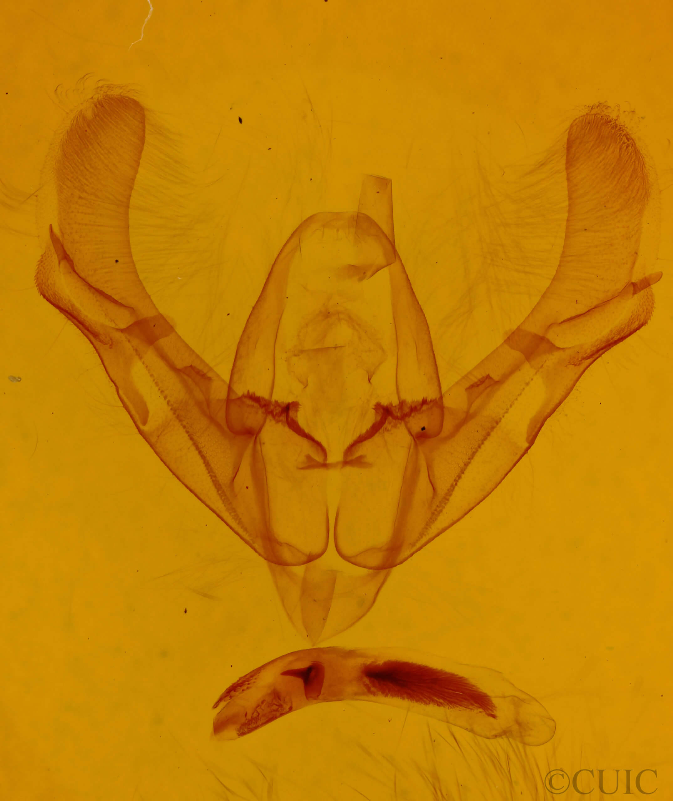 genitalia view of adult Athetis tarda