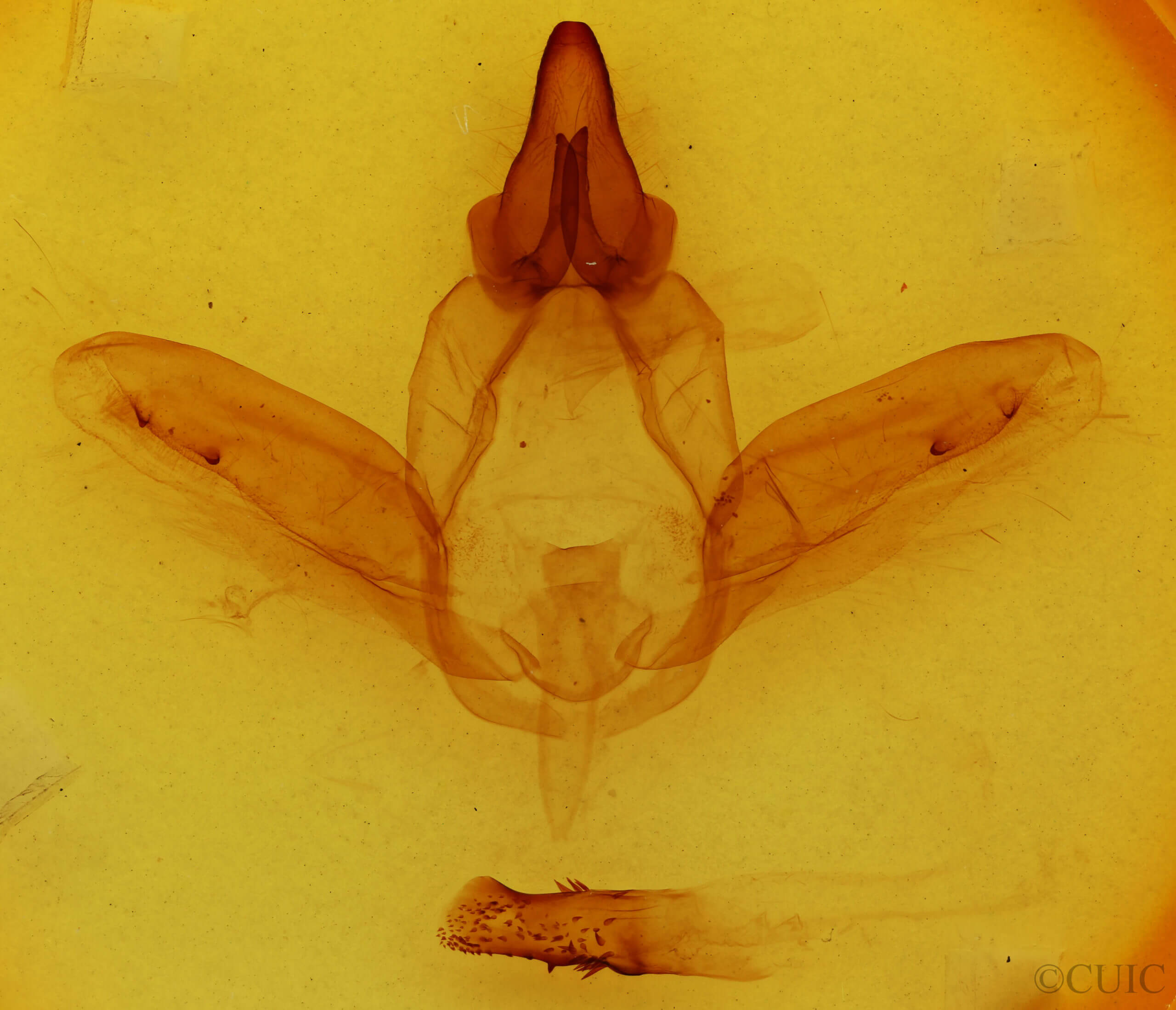 genitalia view of adult Anurocampa mingens