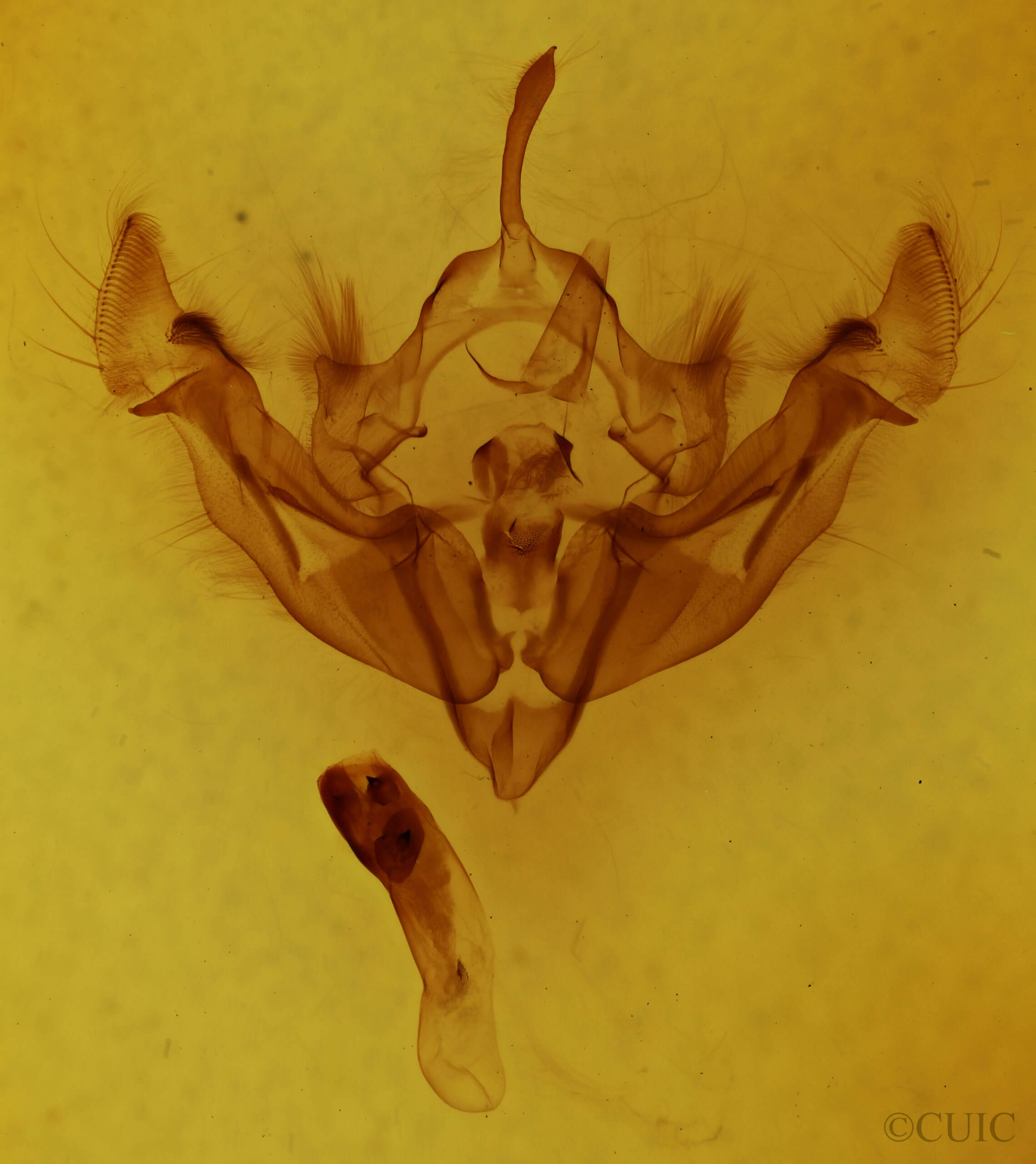 genitalia view of adult Apamea niveivenosa