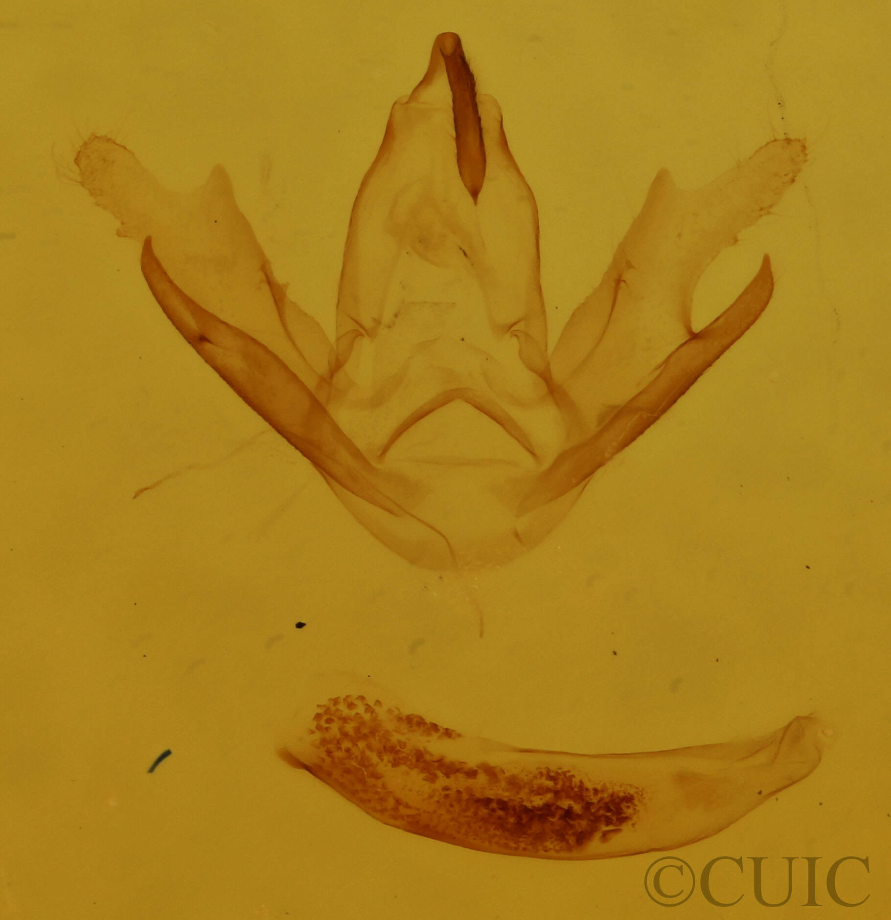 genitalia view of adult Chytolita morbidalis