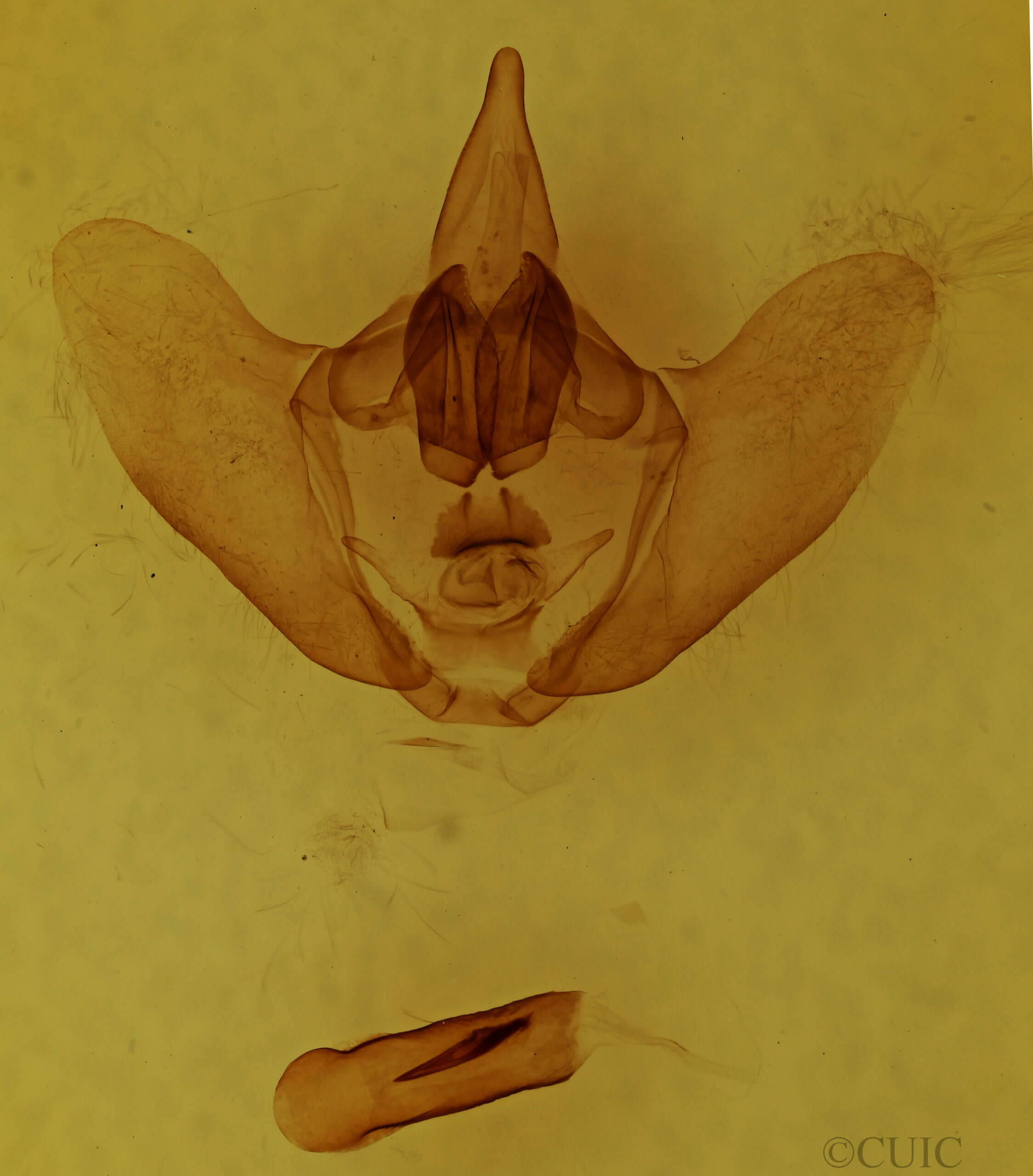 genitalia view of adult Eadmuna