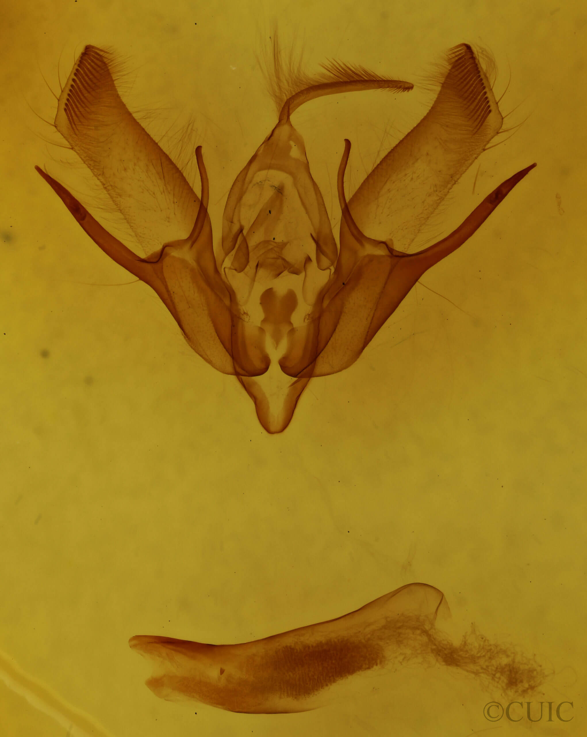 genitalia view of adult Euxoa