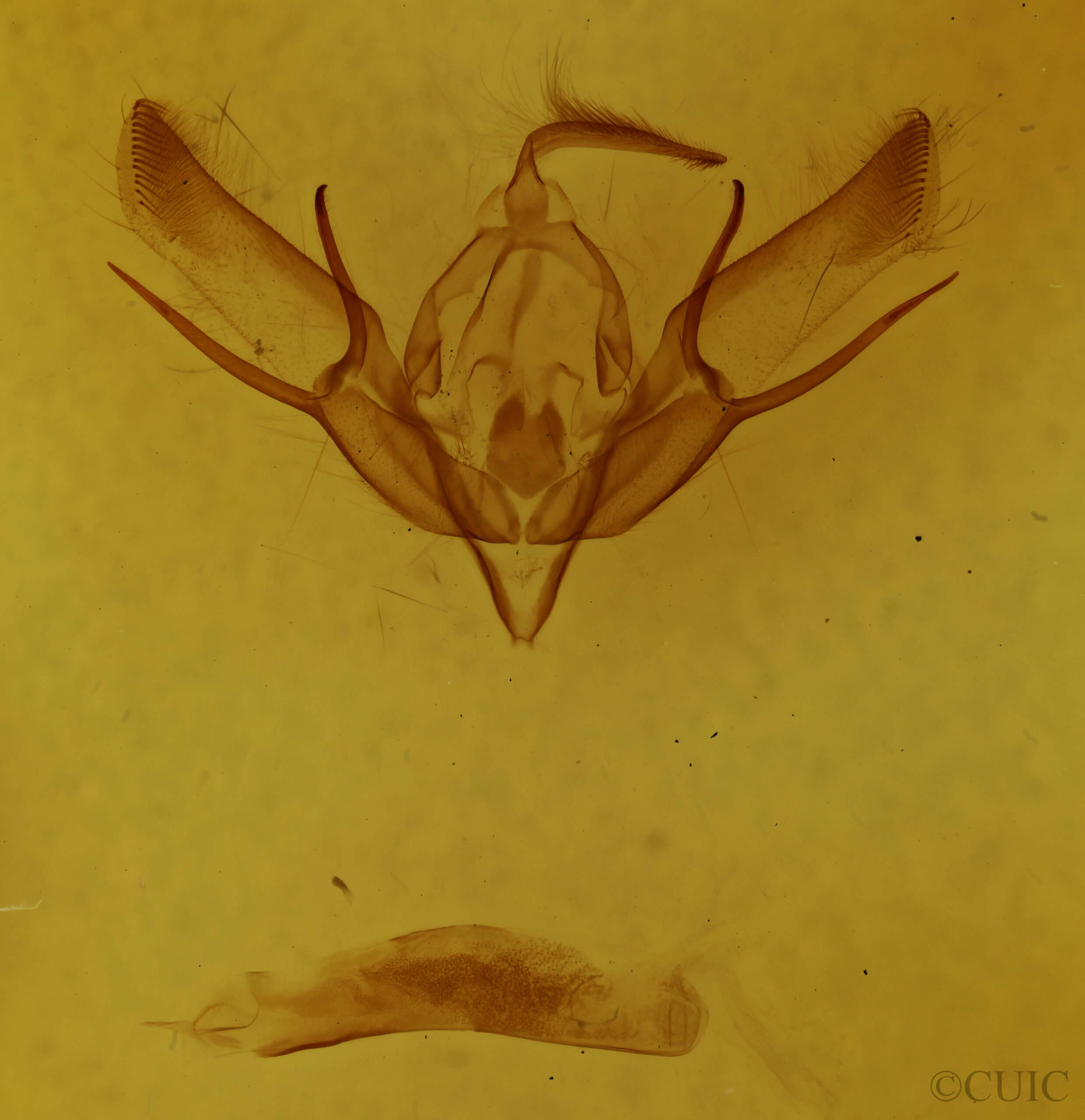 genitalia view of adult Euxoa redimicula