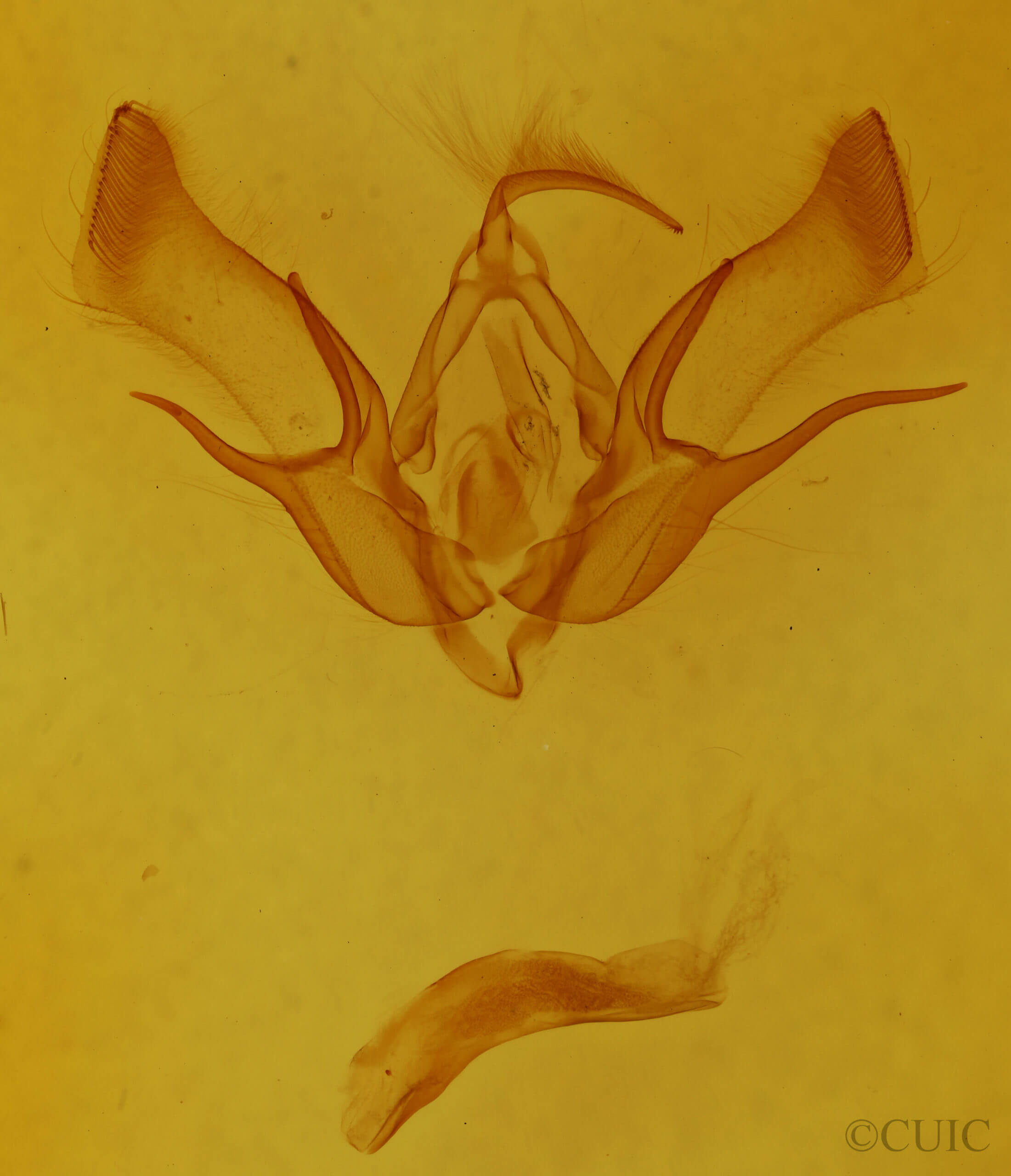 genitalia view of adult Euxoa tessellata