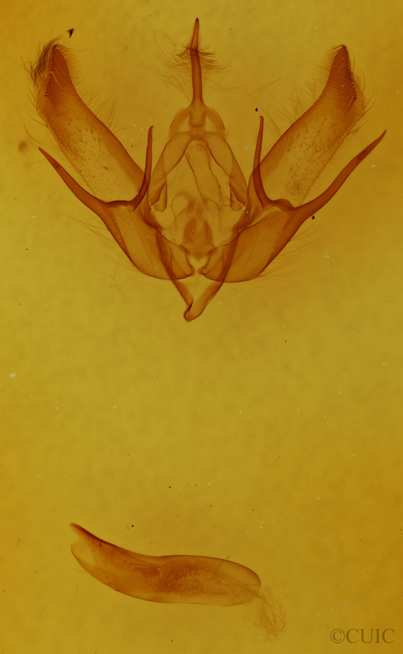 genitalia view of adult Euxoa tessellata