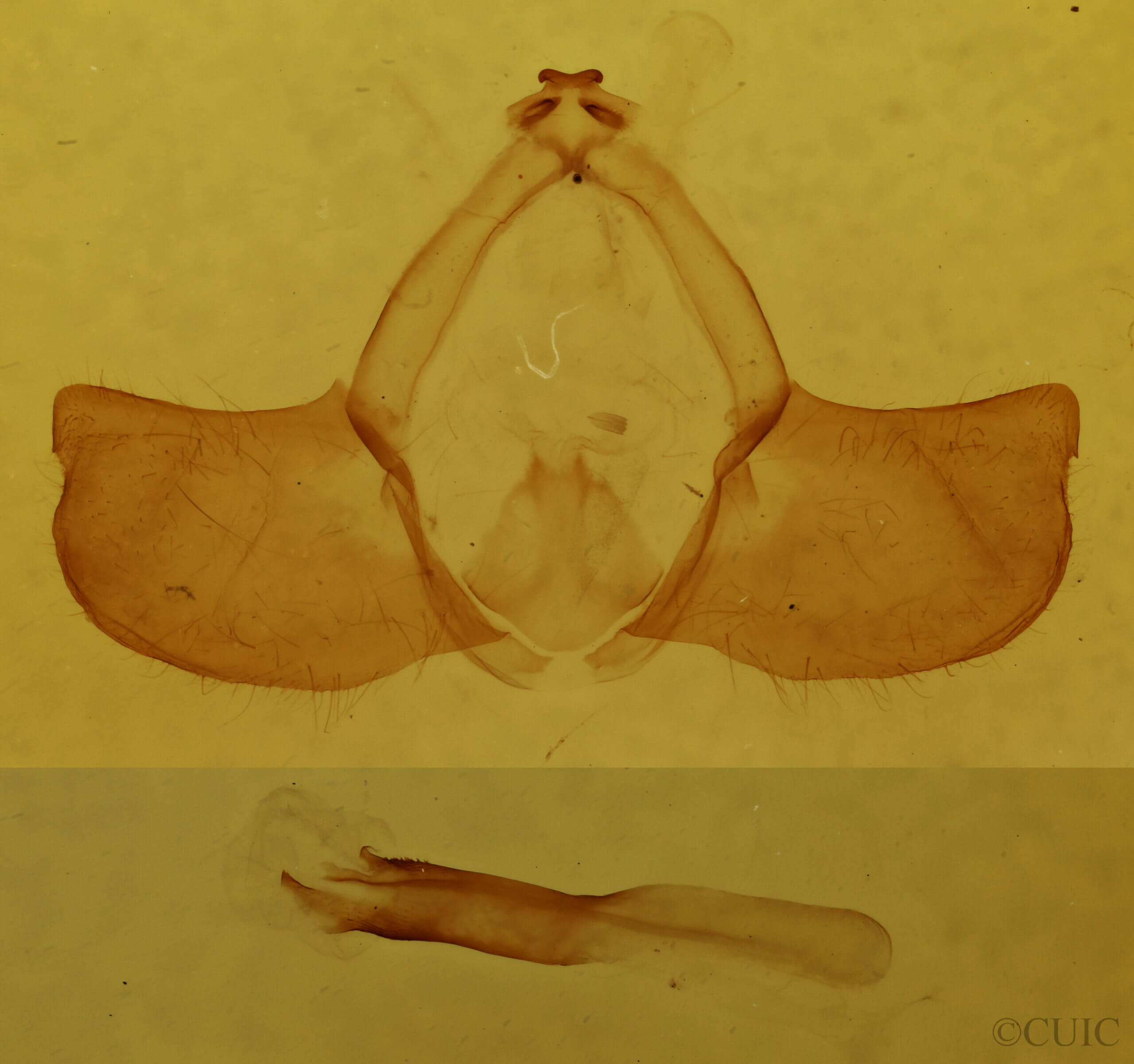 genitalia view of adult Gazalina chrysolopha