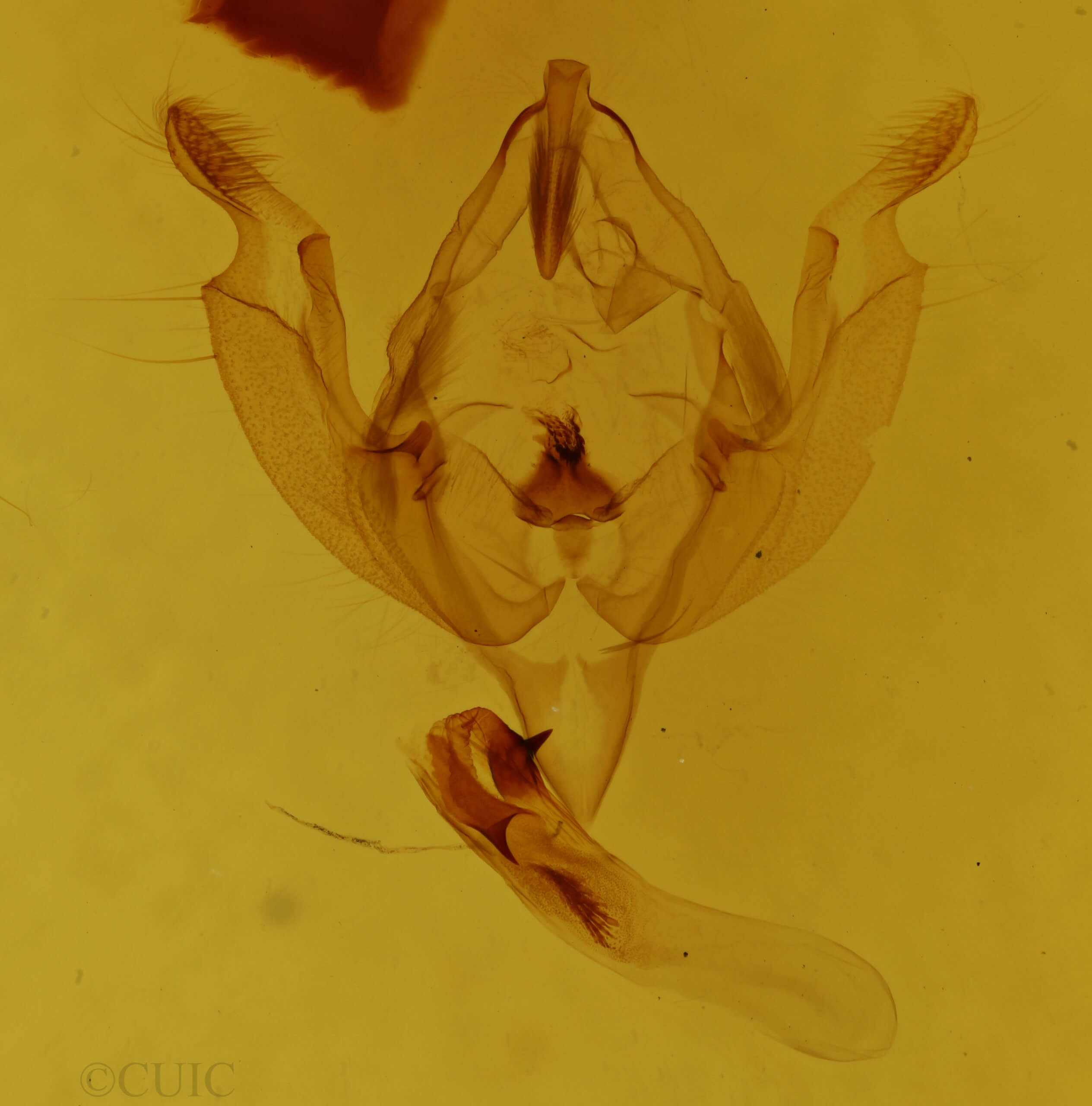genitalia view of adult Hadena capsularis