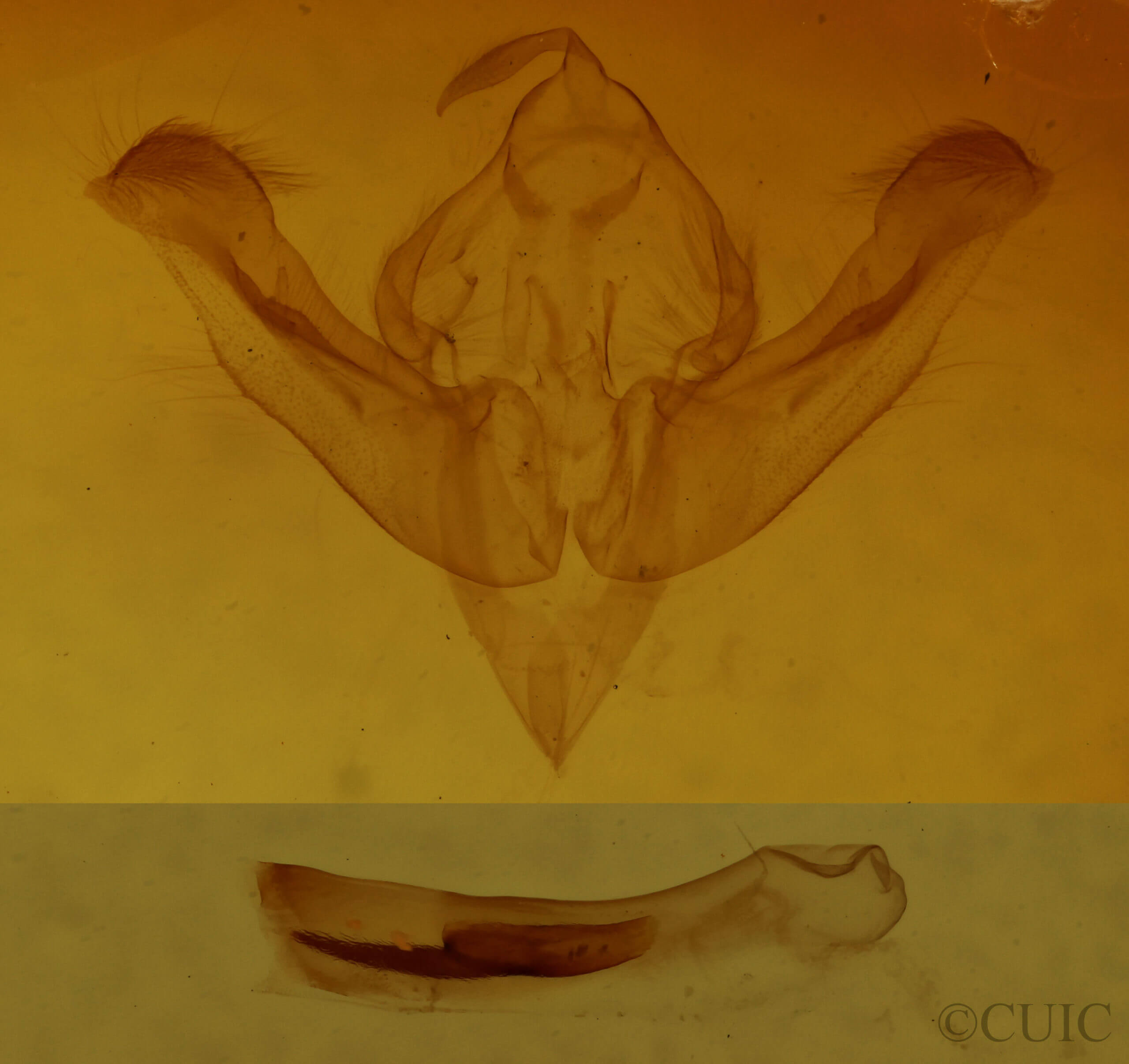 genitalia view of adult Hypocoena inquinata