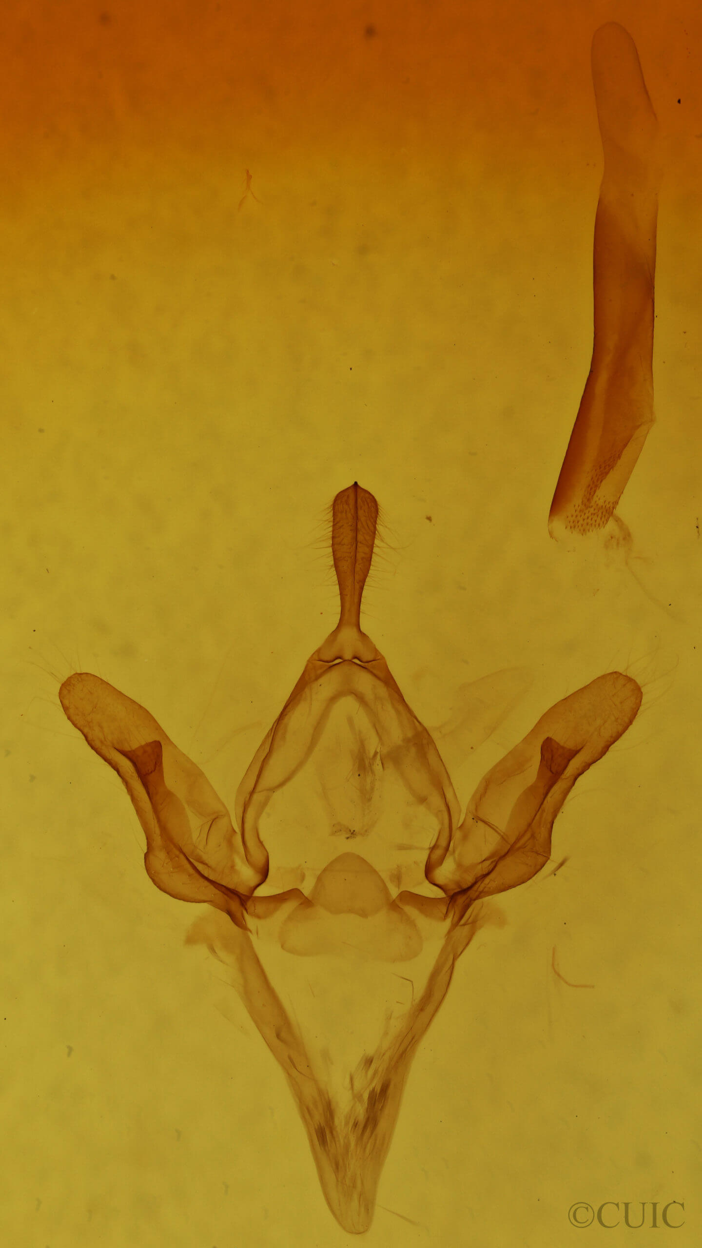 genitalia view of adult Hypsoropha monilis