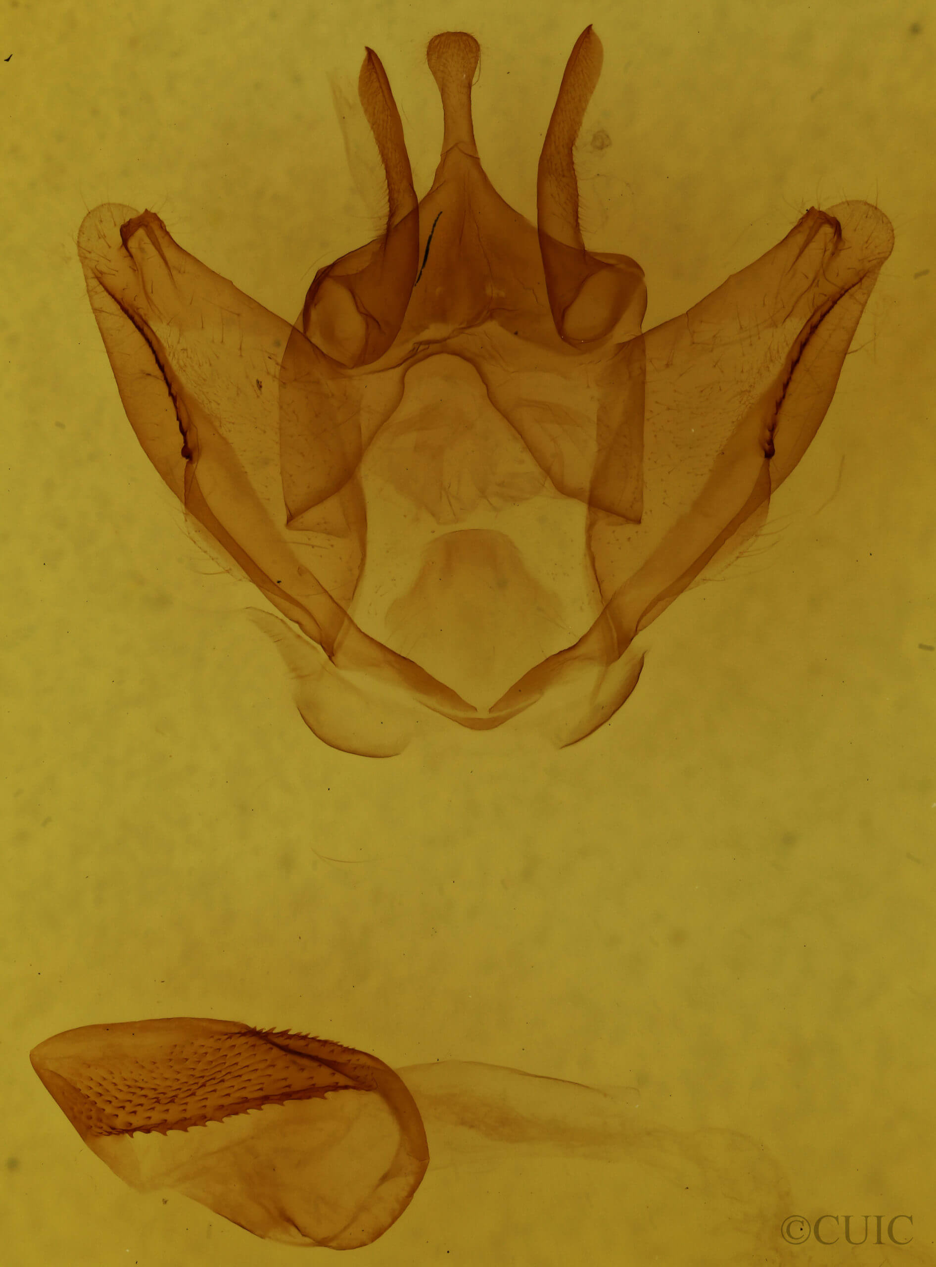 genitalia view of adult Lichya