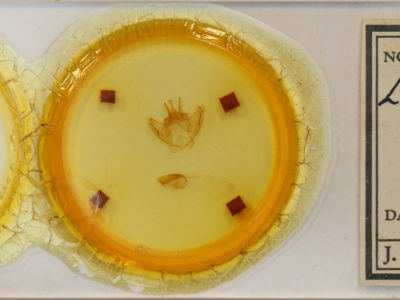 slide view of adult Lichya