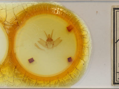 slide view of adult Lichya