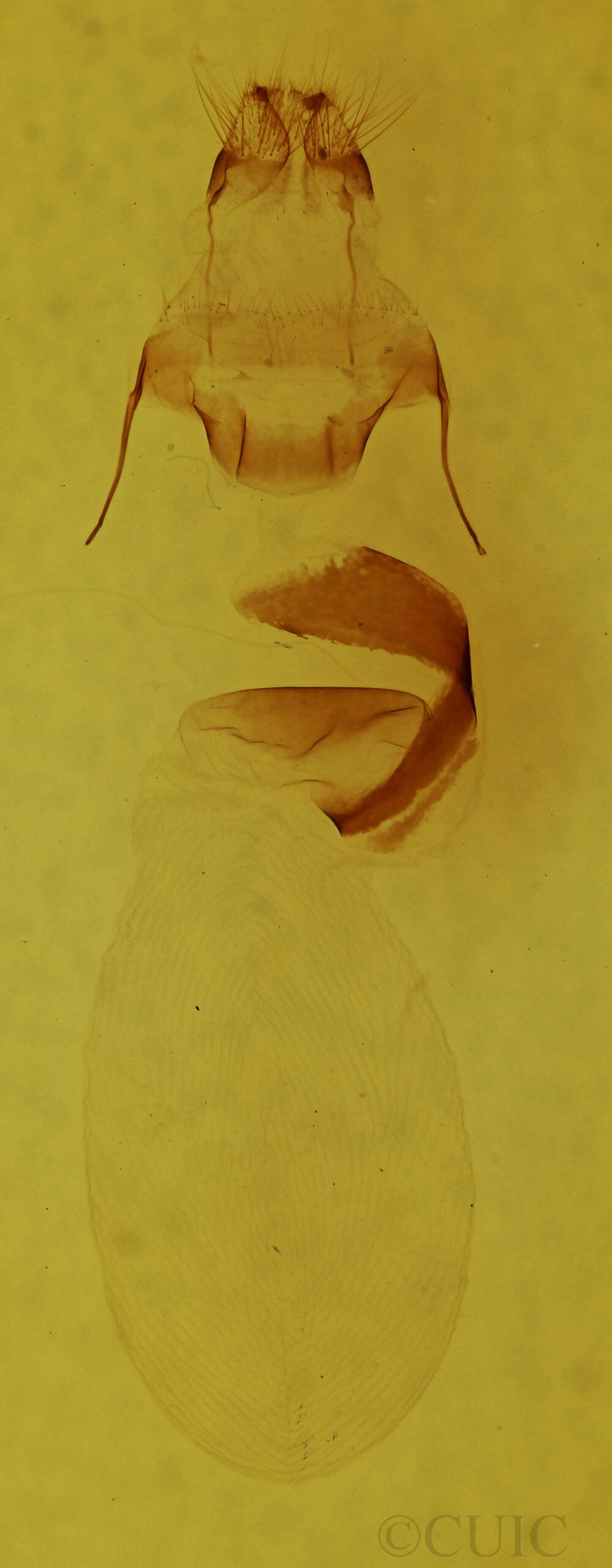 genitalia view of adult Lithophane antennata