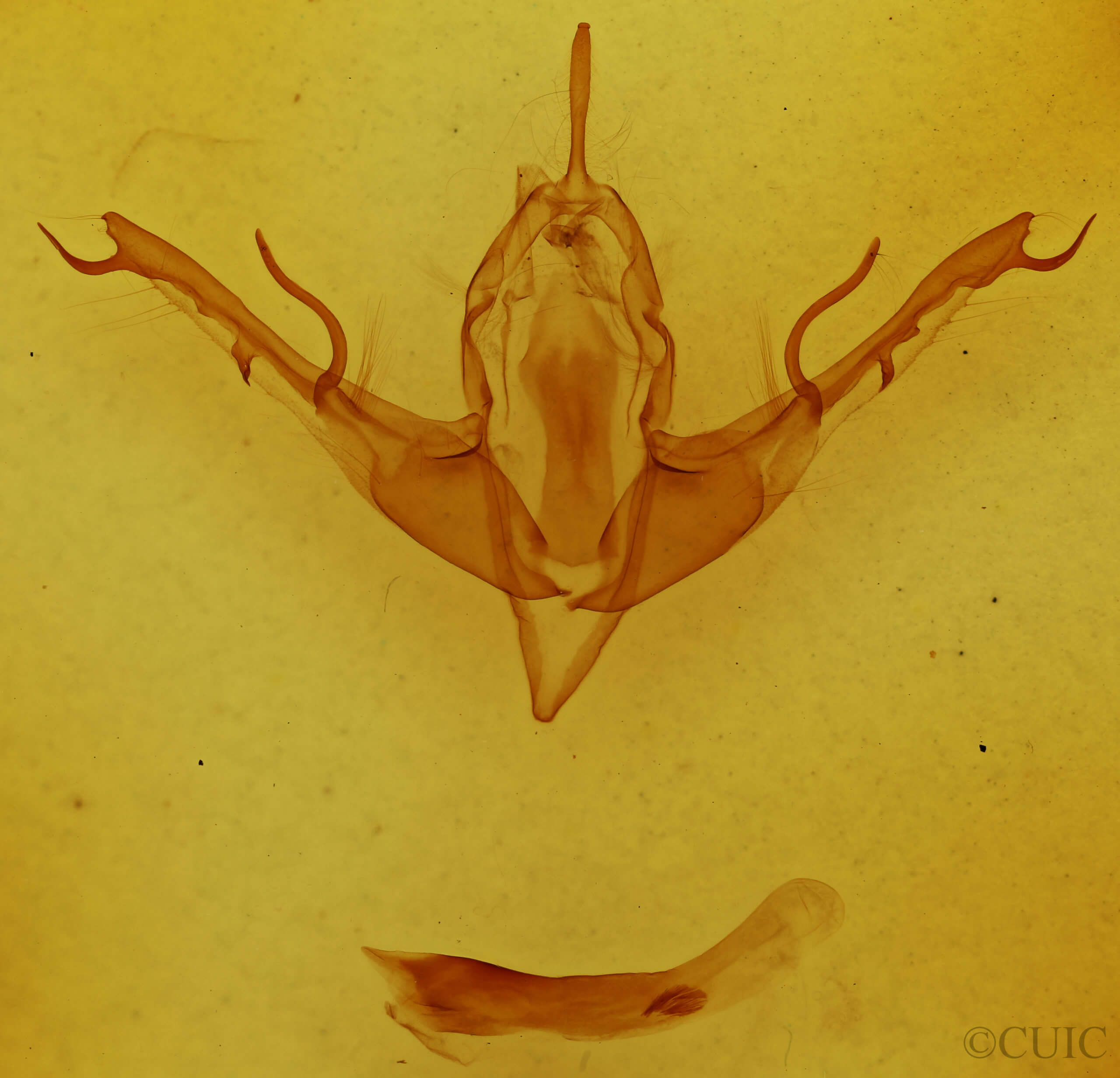 genitalia view of adult Lithophane baileyi