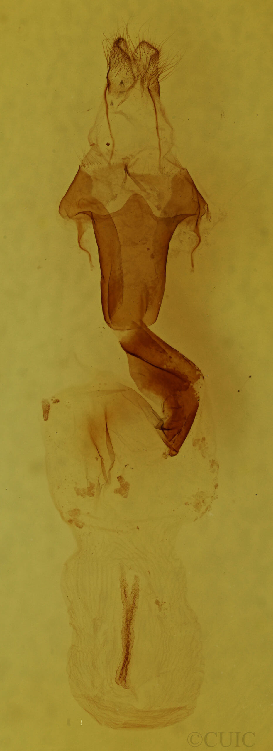 genitalia view of adult Lithophane fagina