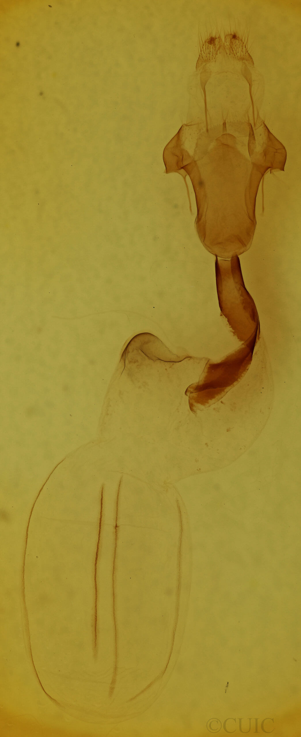 genitalia view of adult Lithophane hemina