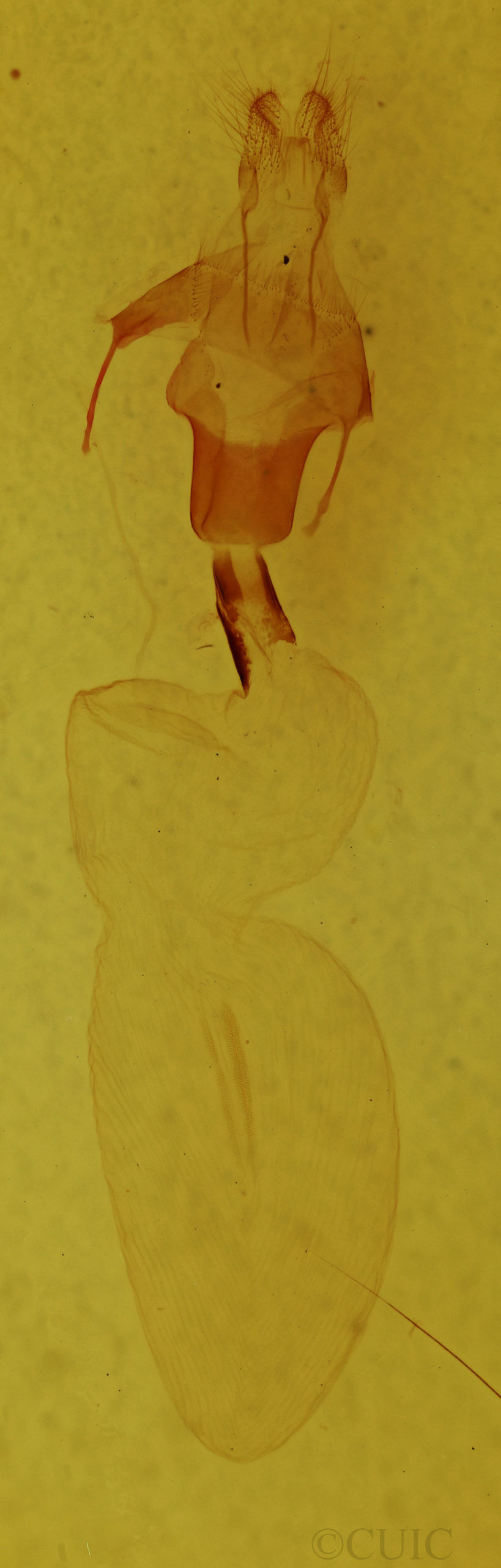 genitalia view of adult Lithophane pexata
