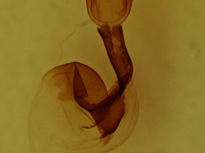 genitalia view of adult Lithophane signosa