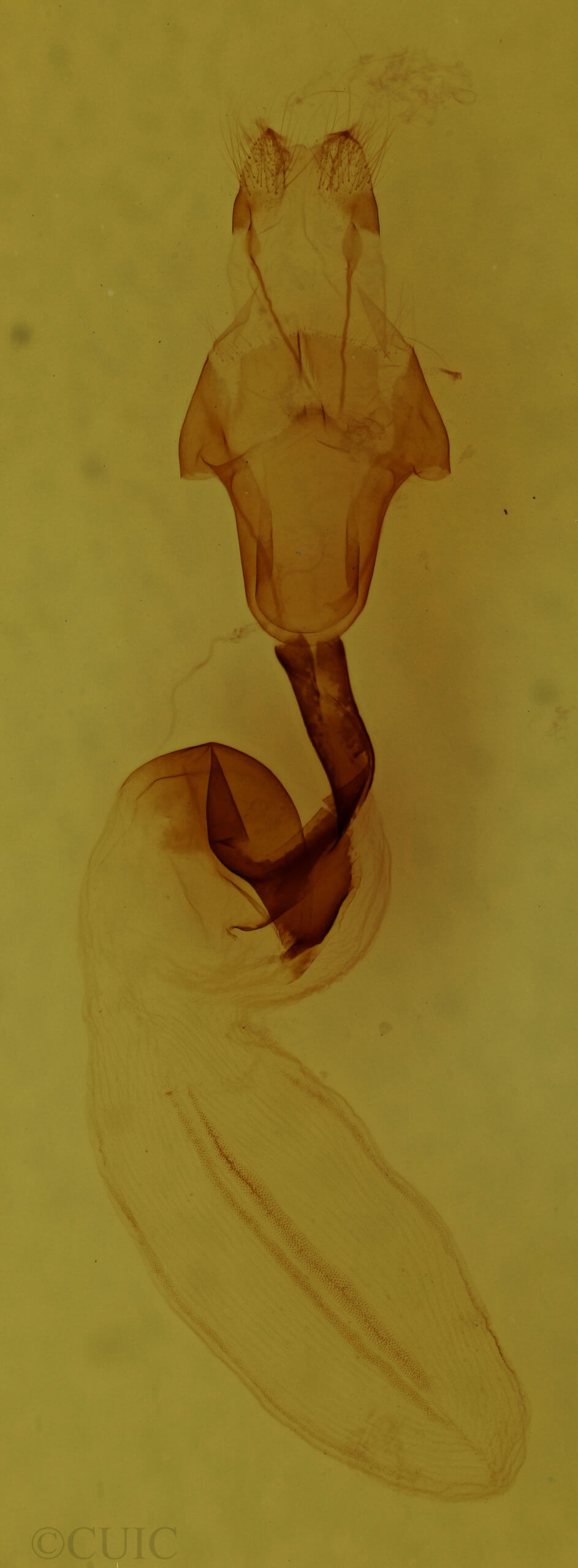 genitalia view of adult Lithophane signosa