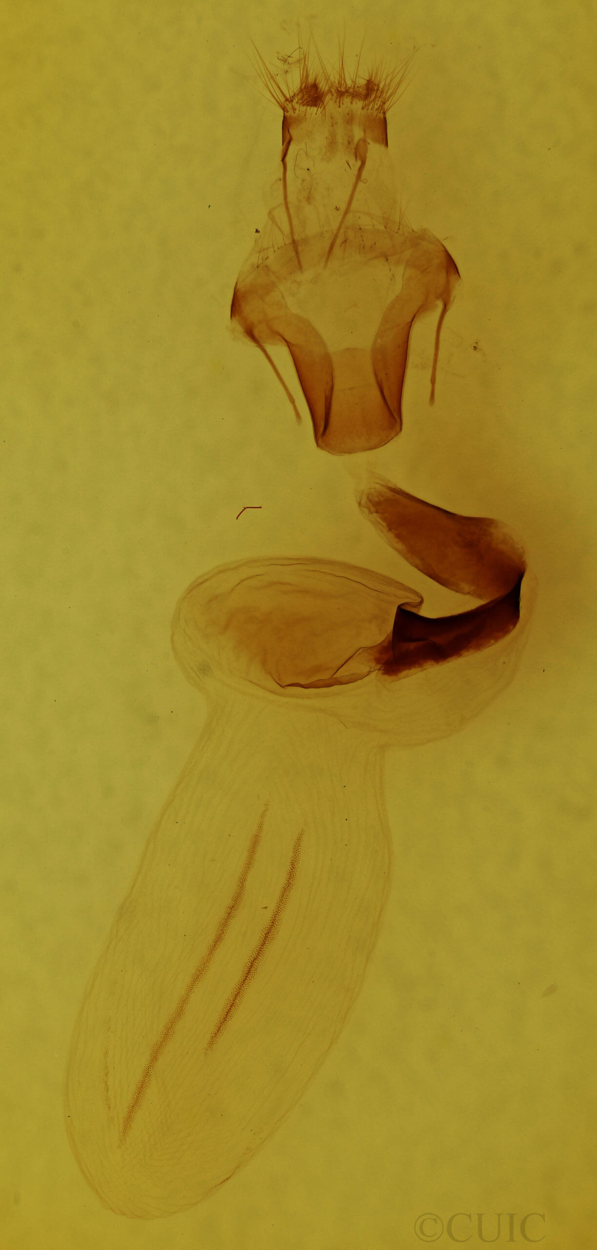 genitalia view of adult Lithophane unimoda